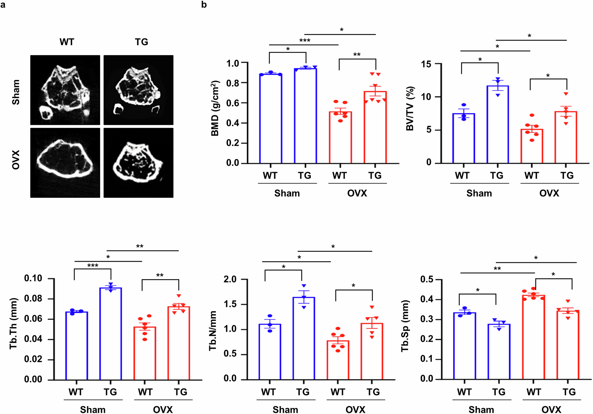 Fig. 1: sLZIP promotes bone formation and inhibits bone mass reduction in osteoporosis.