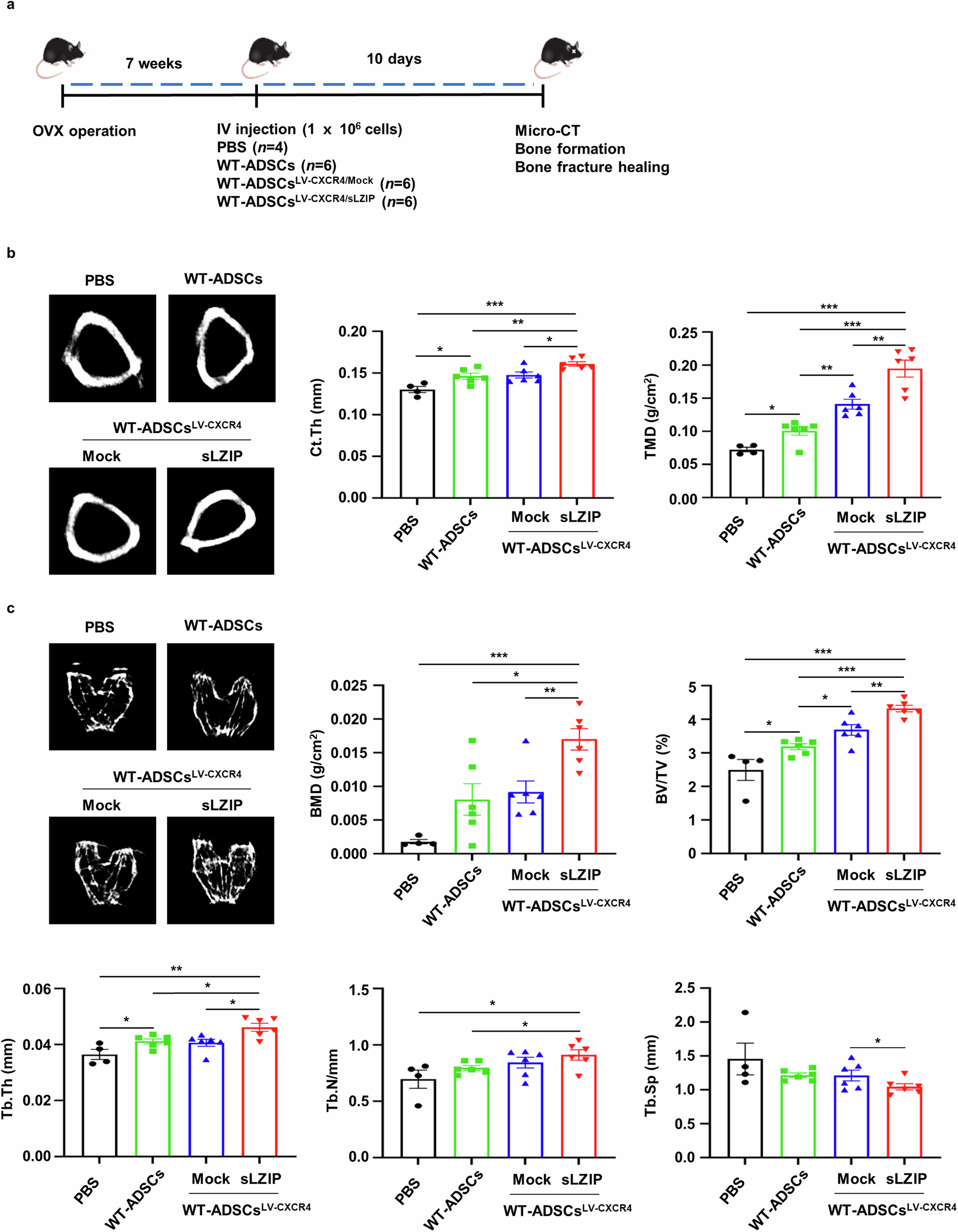 Fig. 7: sLZIP-overexpressing ADS cells promote bone formation in osteoporosis.