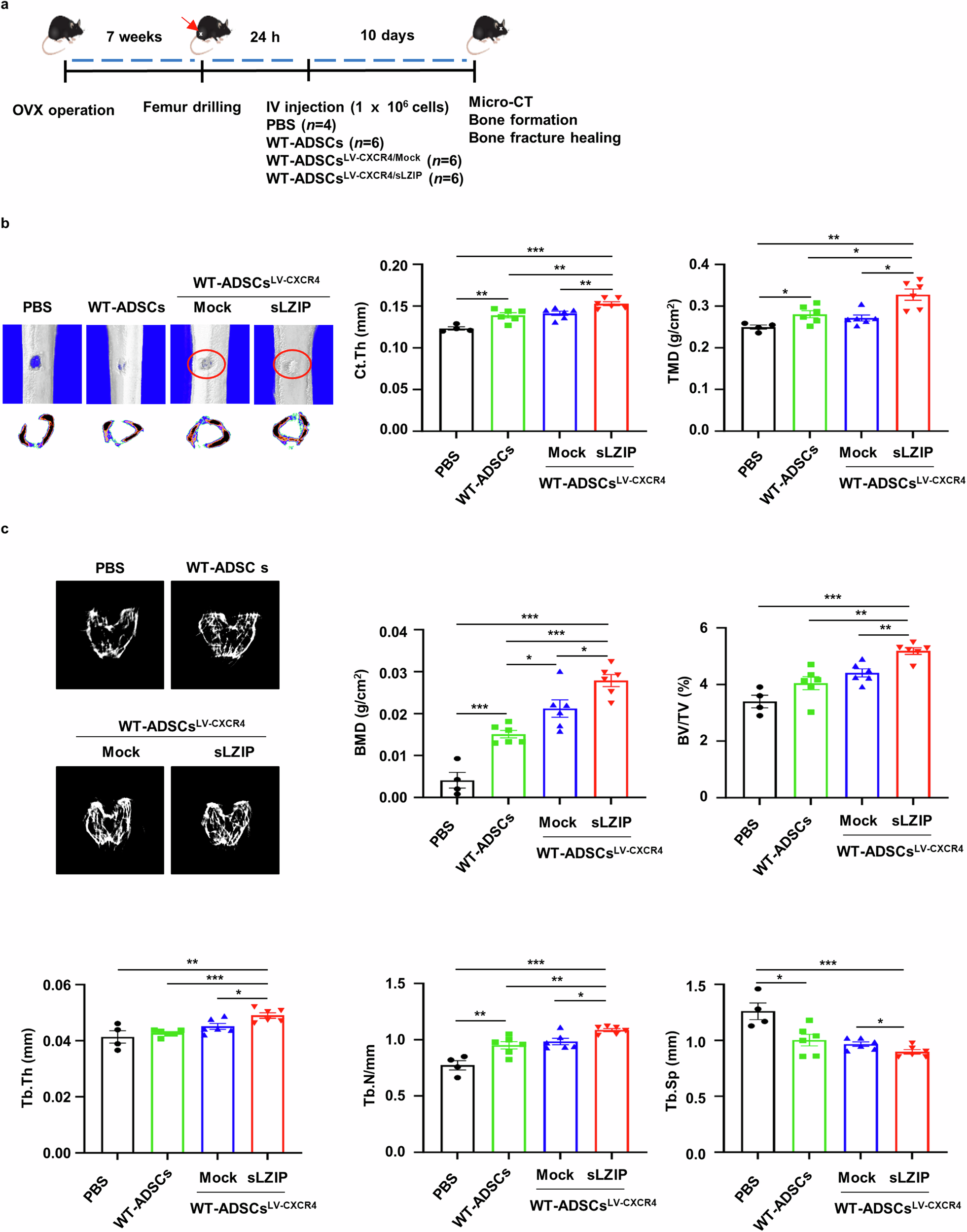Fig. 8: sLZIP-overexpressing ADS cells promote bone repair in osteoporosis.