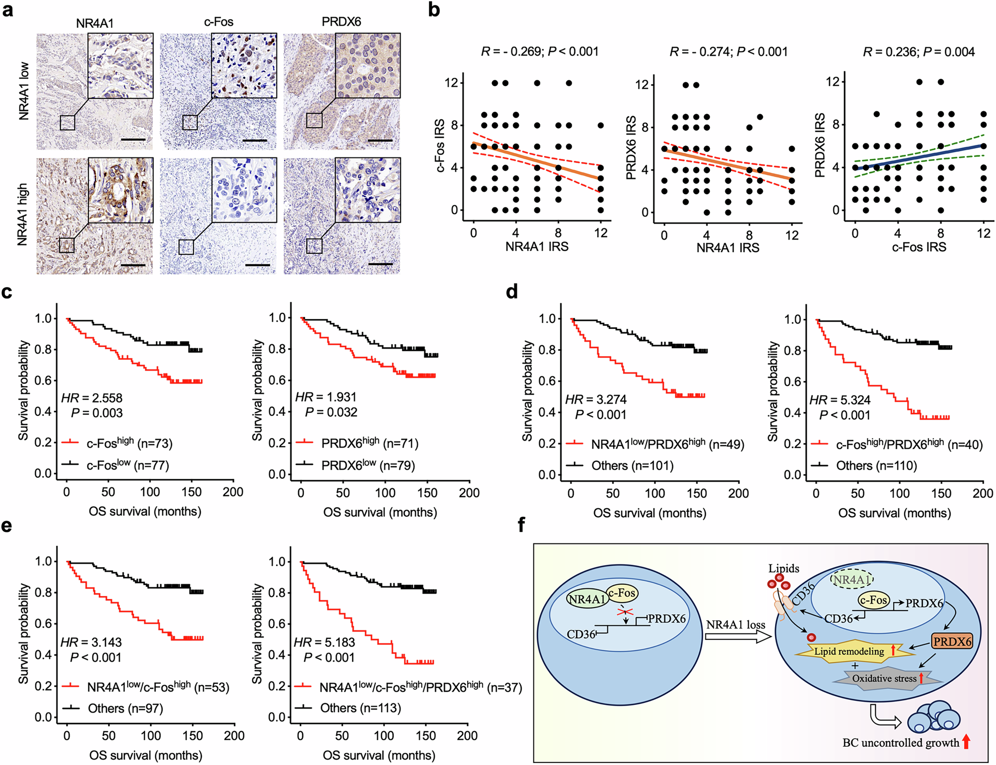 Fig. 8: The impact of NR4A1–c-Fos–PRDX6 axis on BC prognosis.