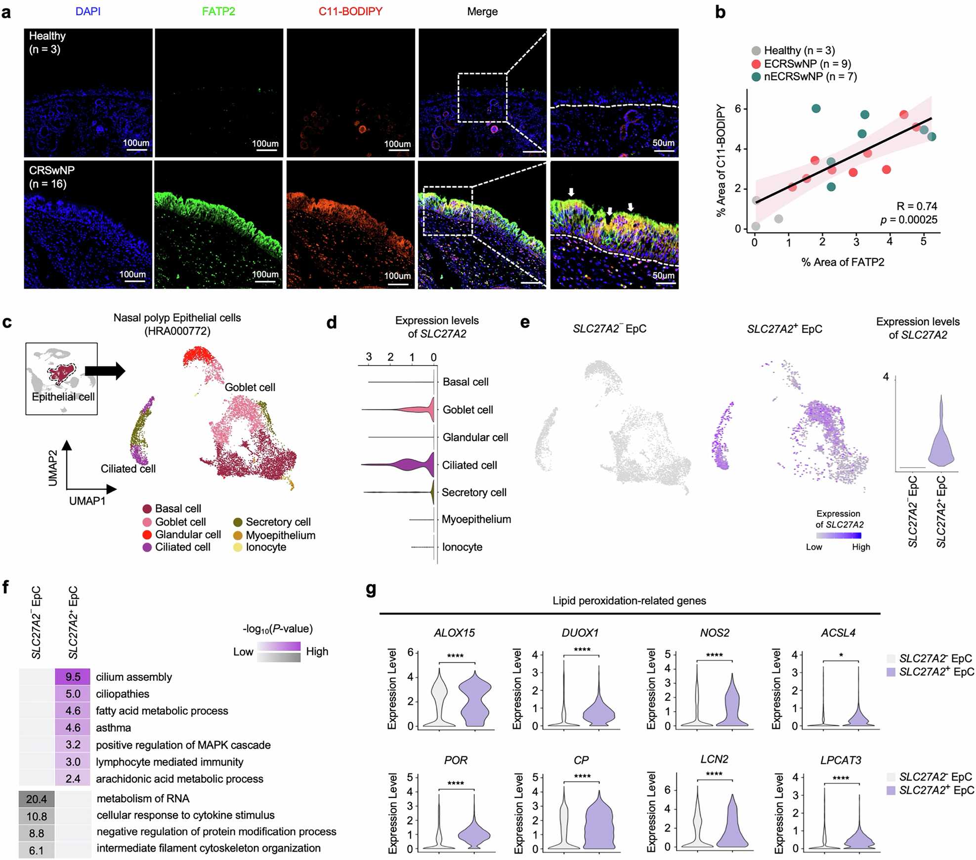 Fig. 5: Transcriptomic signatures and elevated lipid peroxidation in SLC27A2+ NP EpCs.