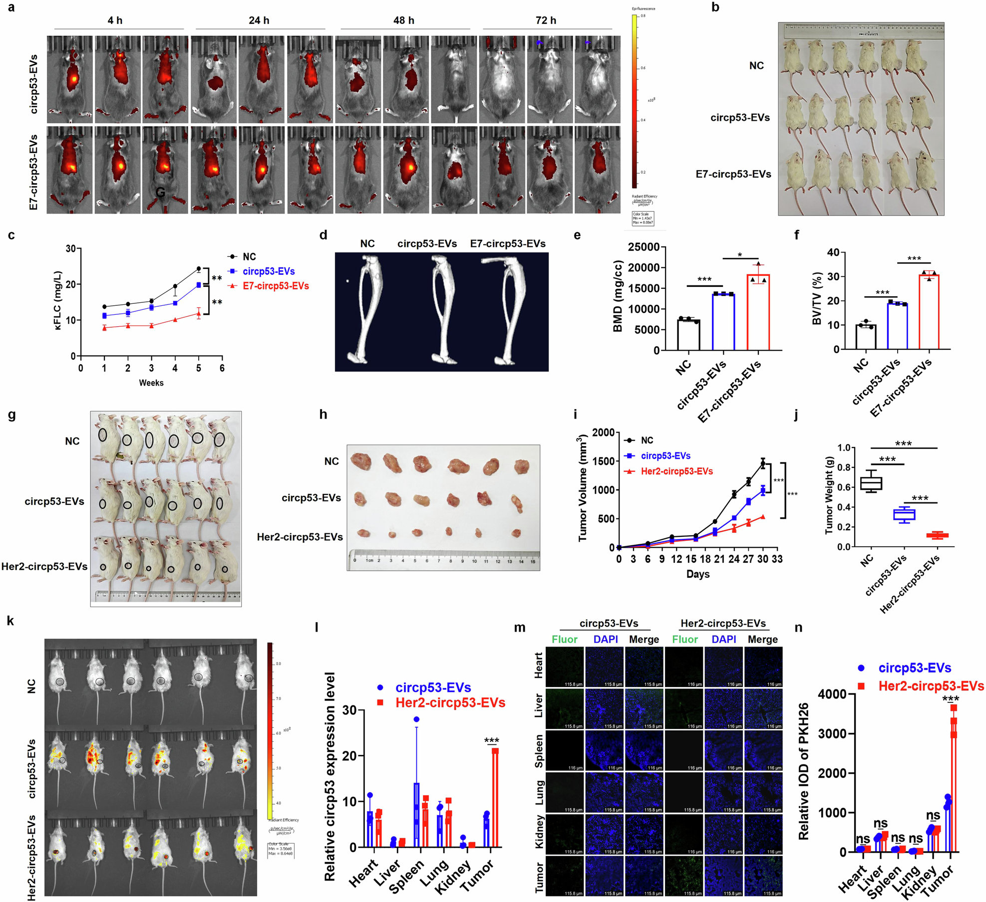 Fig. 7: E7-circp53-EVs and Her2-circp53-EVs selectively inhibit tumor growth in PDX and NOD/SCID-TIBIA mouse models.