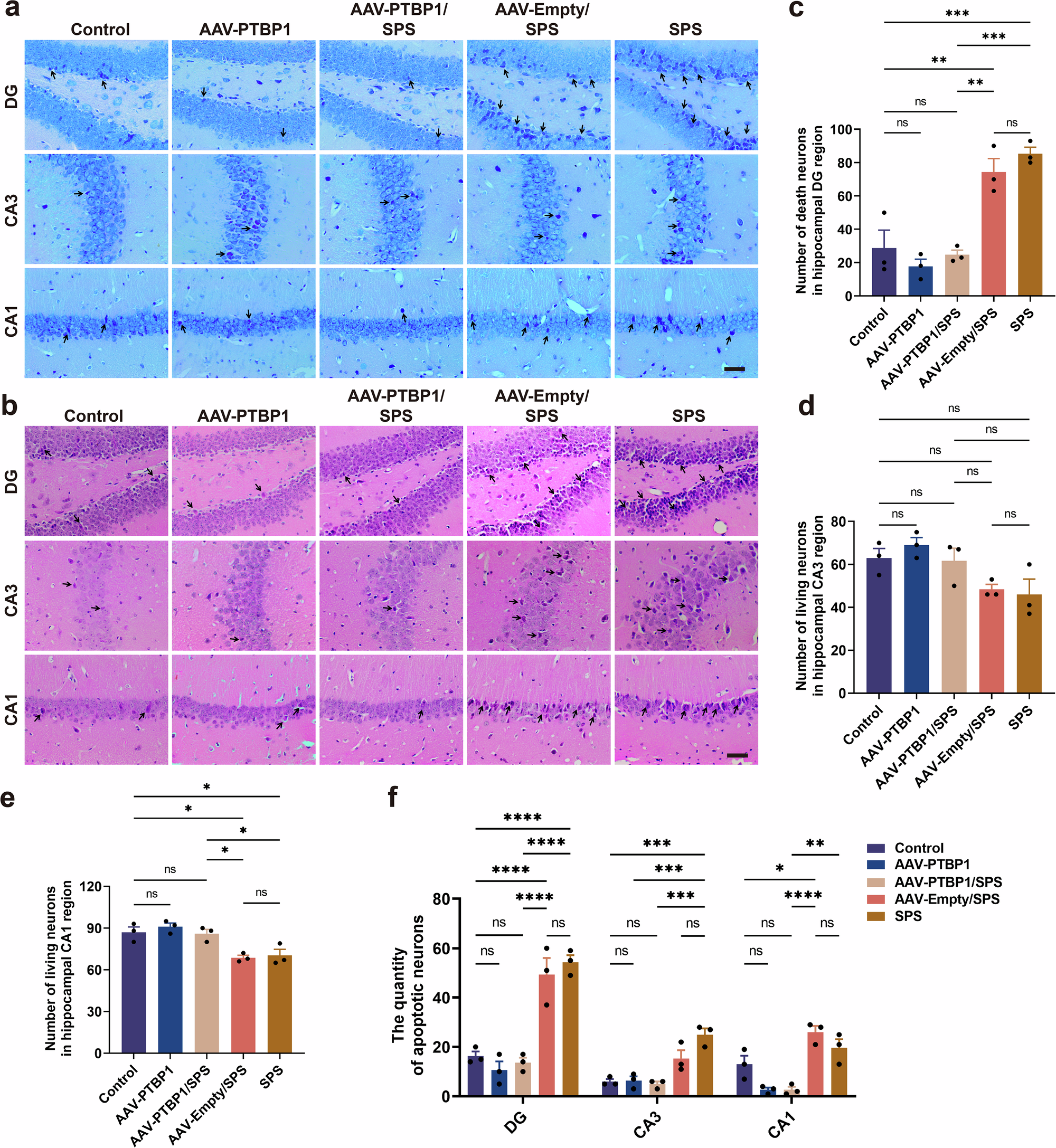 Fig. 3: PTBP1 KD reduces hippocampal neuronal loss in SPS-induced PTSD mice.