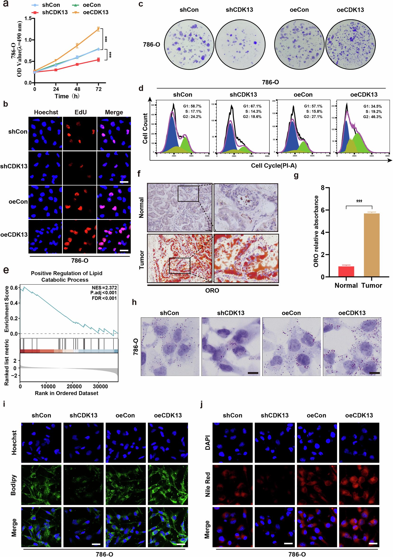 Fig. 2: CDK13 enhances proliferation and drives fatty acid biosynthesis and lipid accumulation in ccRCC.