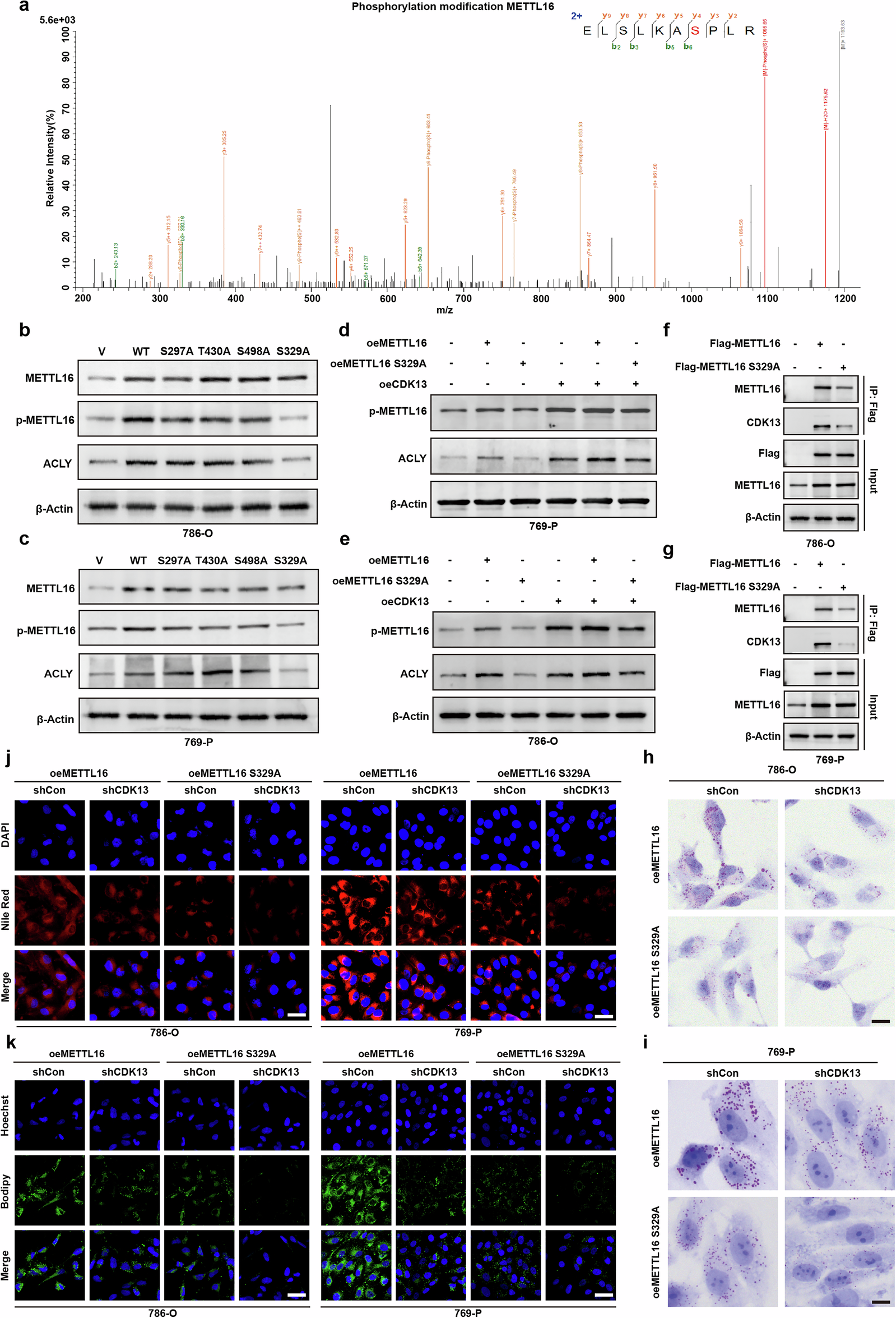 Fig. 6: CDK13-mediated phosphorylation of METTL16 drives lipid metabolic reprogramming.