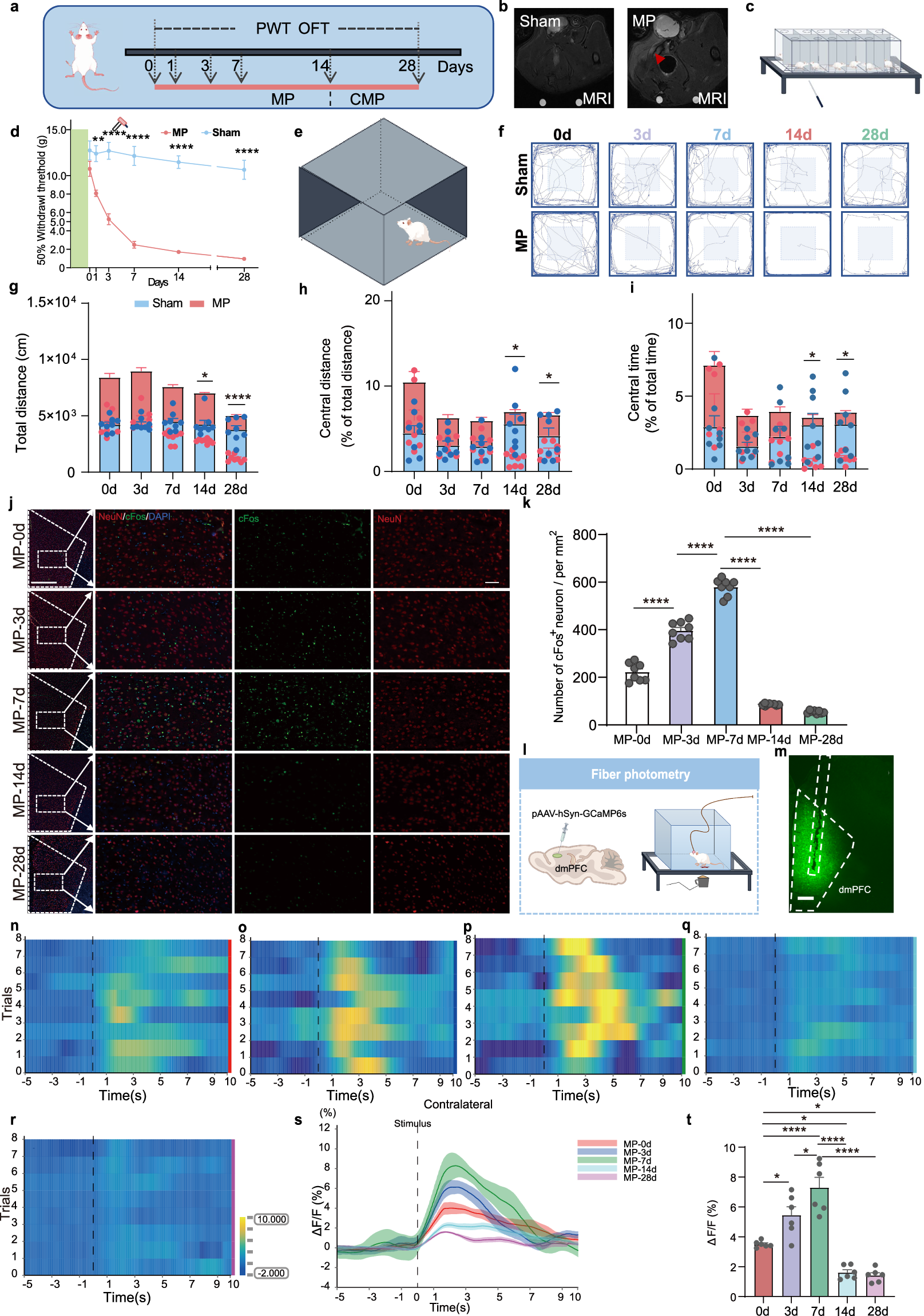Fig. 1: The dmPFC is suppressed in rats with CMP.