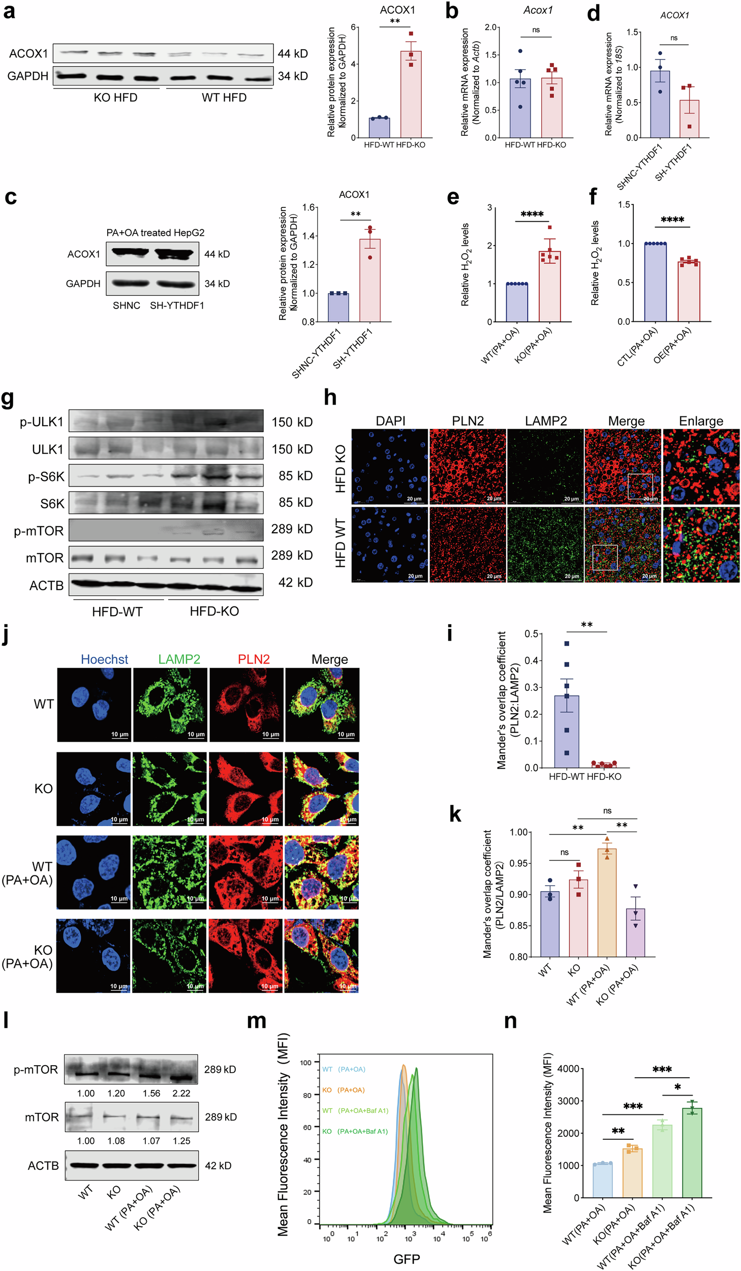 Fig. 4: Hepatic loss of YTHDF1 increases excessive peroxisome activation by promoting ACOX1 translation under high lipid stress.
