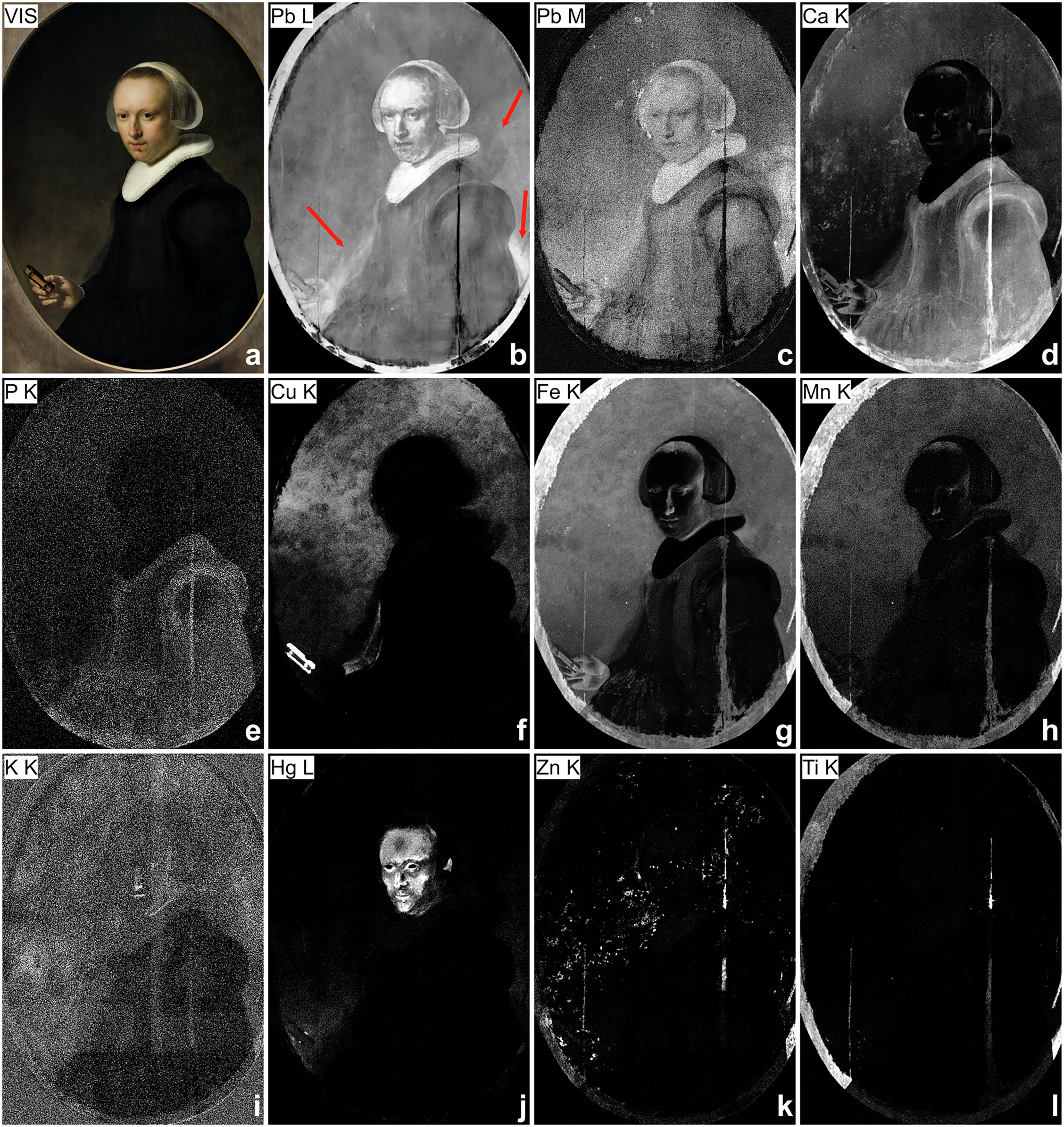 Fig. 2: Portrait of a 39-Year-Old Woman.