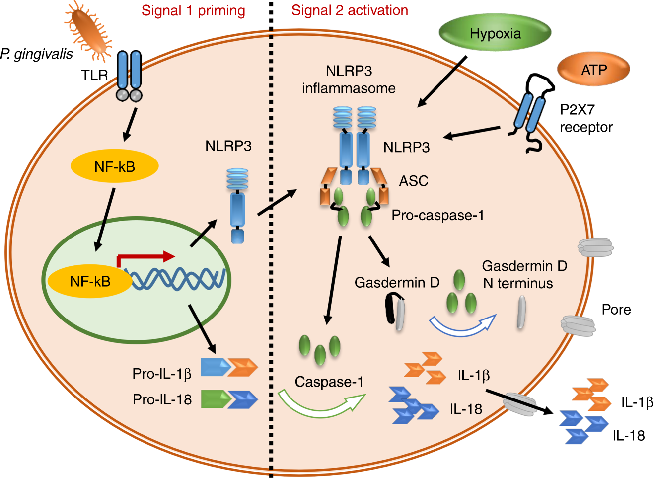 Interleukin-1β is a potential therapeutic target for periodontitis: a  narrative review | International Journal of Oral Science