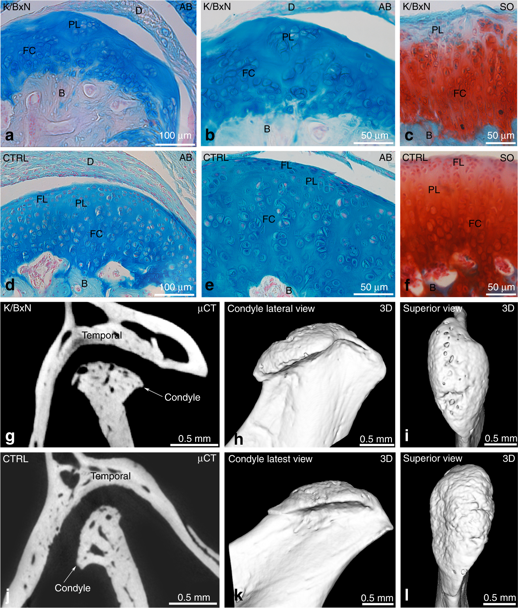 Temporomandibular joint damage in K/BxN arthritic mice | International  Journal of Oral Science, image size:1717x2014