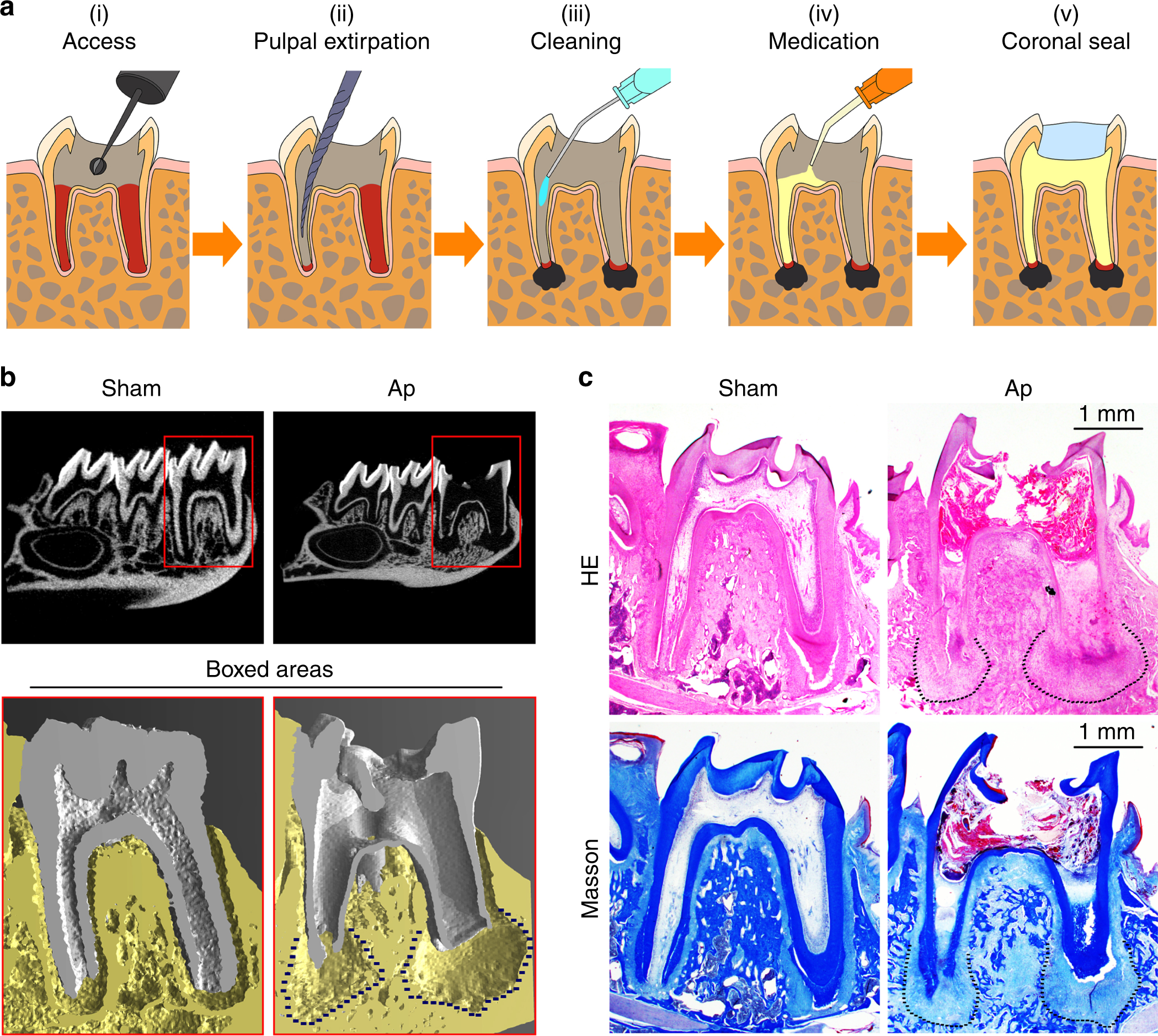 Substrate Compliance Directs the Osteogenic Lineages of Stem Cells from the  Human Apical Papilla via the Processes of Mechanosensing and  Mechanotransduction