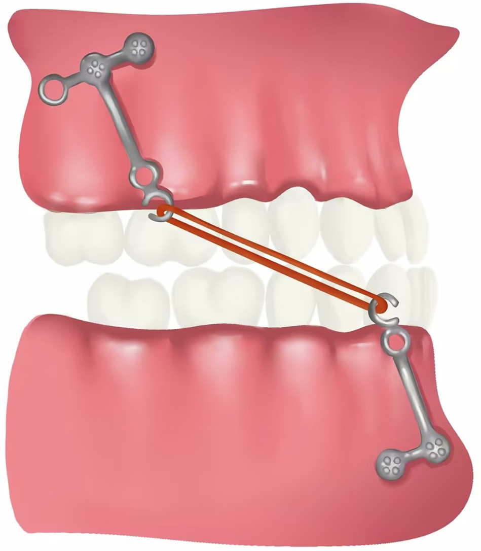 Fig. 8