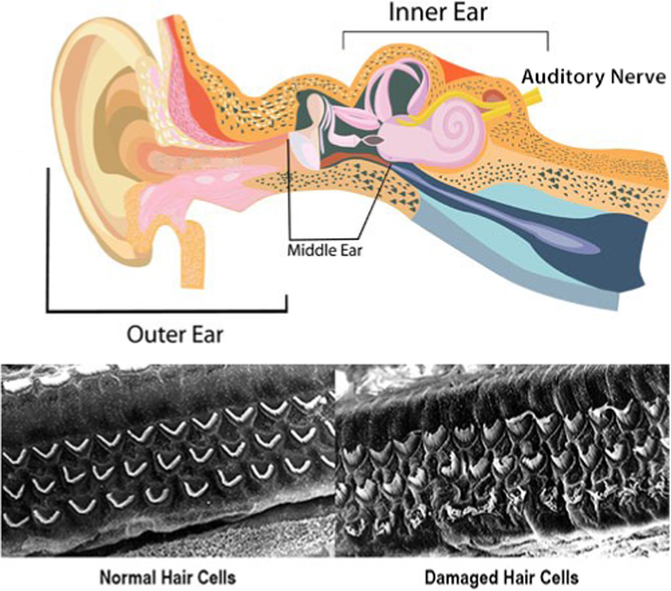 What is the safe noise exposure level to prevent noise-induced 