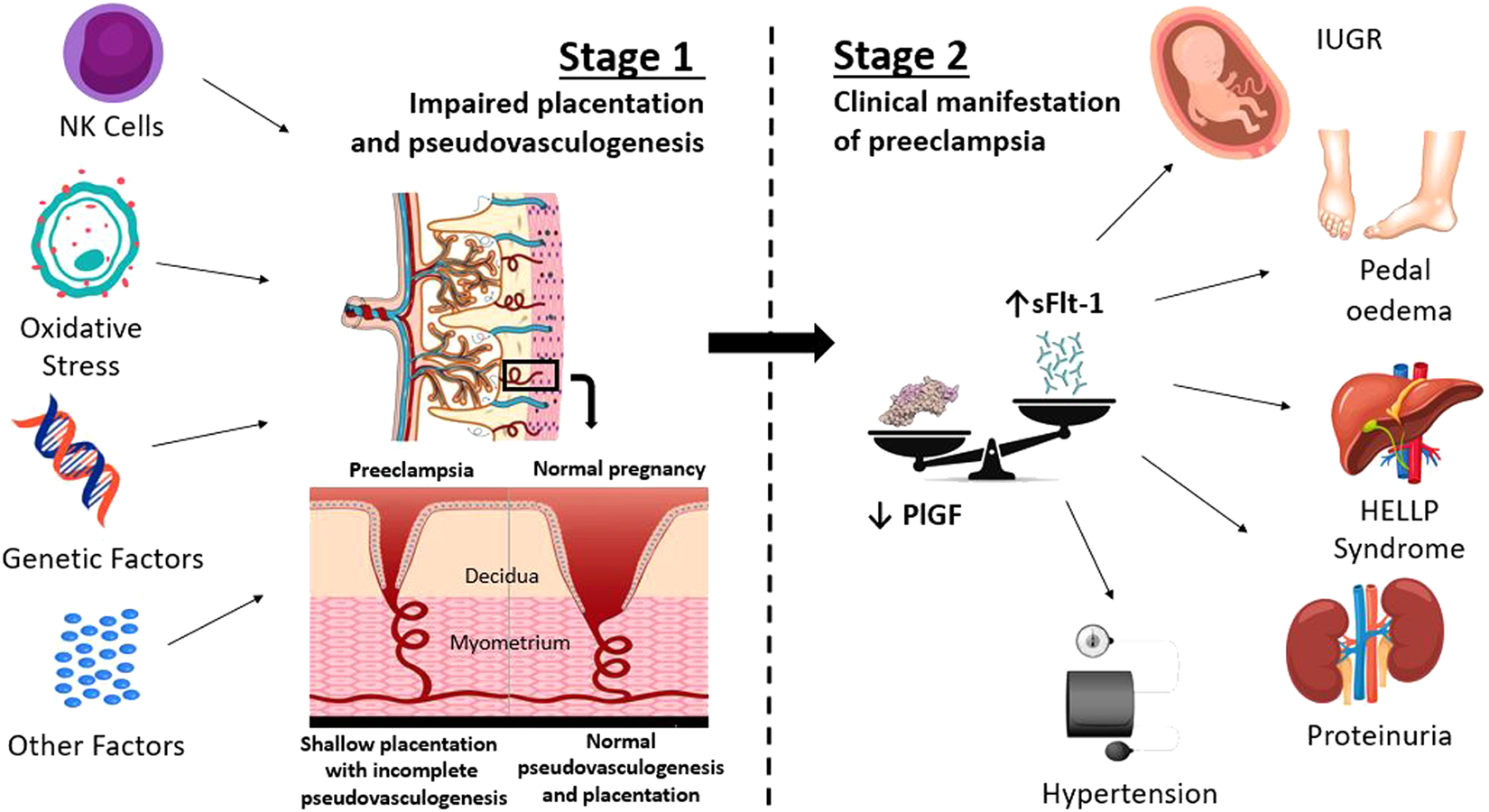 Aspirin in the prevention of preeclampsia: the conundrum of how, who and  when | Journal of Human Hypertension