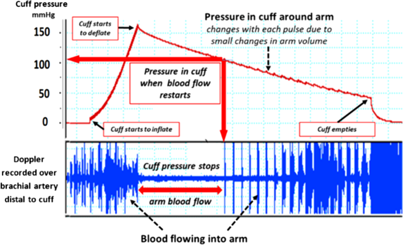 Blood Pressure: Definition, Measurement, Mechanism