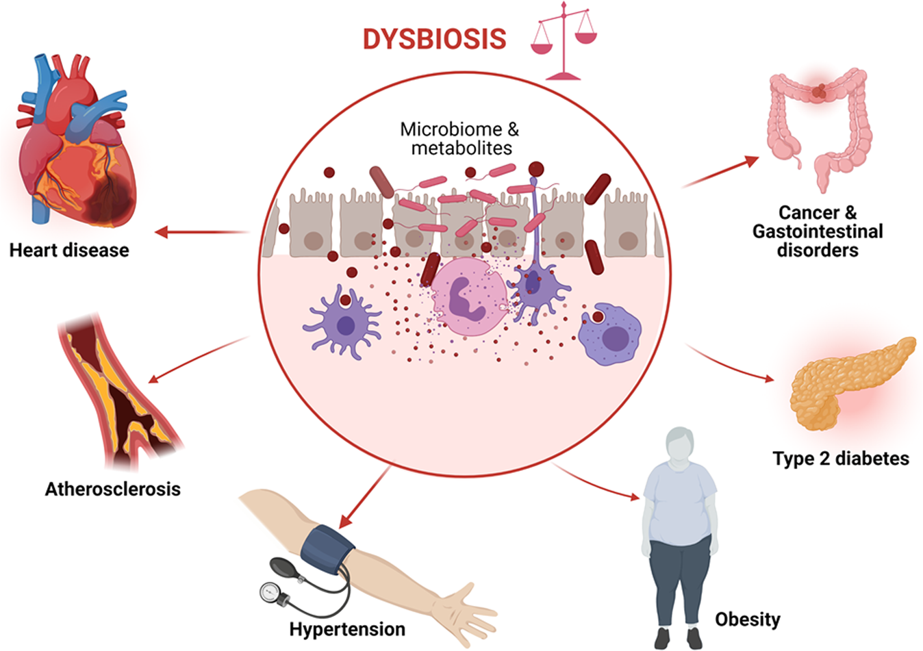 Recent advances in modulation of cardiovascular diseases by the gut  microbiota | Journal of Human Hypertension