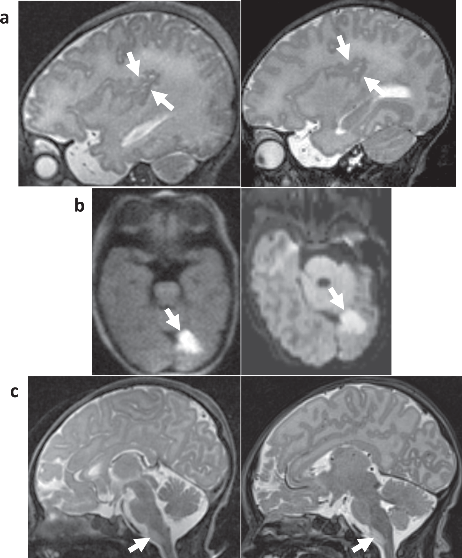 Clinical experience with an in-NICU magnetic resonance imaging system |  Journal of Perinatology