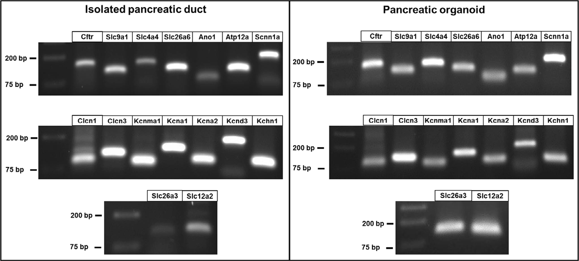 Mouse Pancreatic Ductal Organoid Culture As A Relevant Model To Study Exocrine Pancreatic Ion Secretion Laboratory Investigation Mouse Pancreatic Ductal Organoid Culture As A Relevant Model To Study Exocrine Pancreatic Ion Secretion Laboratory Investigation