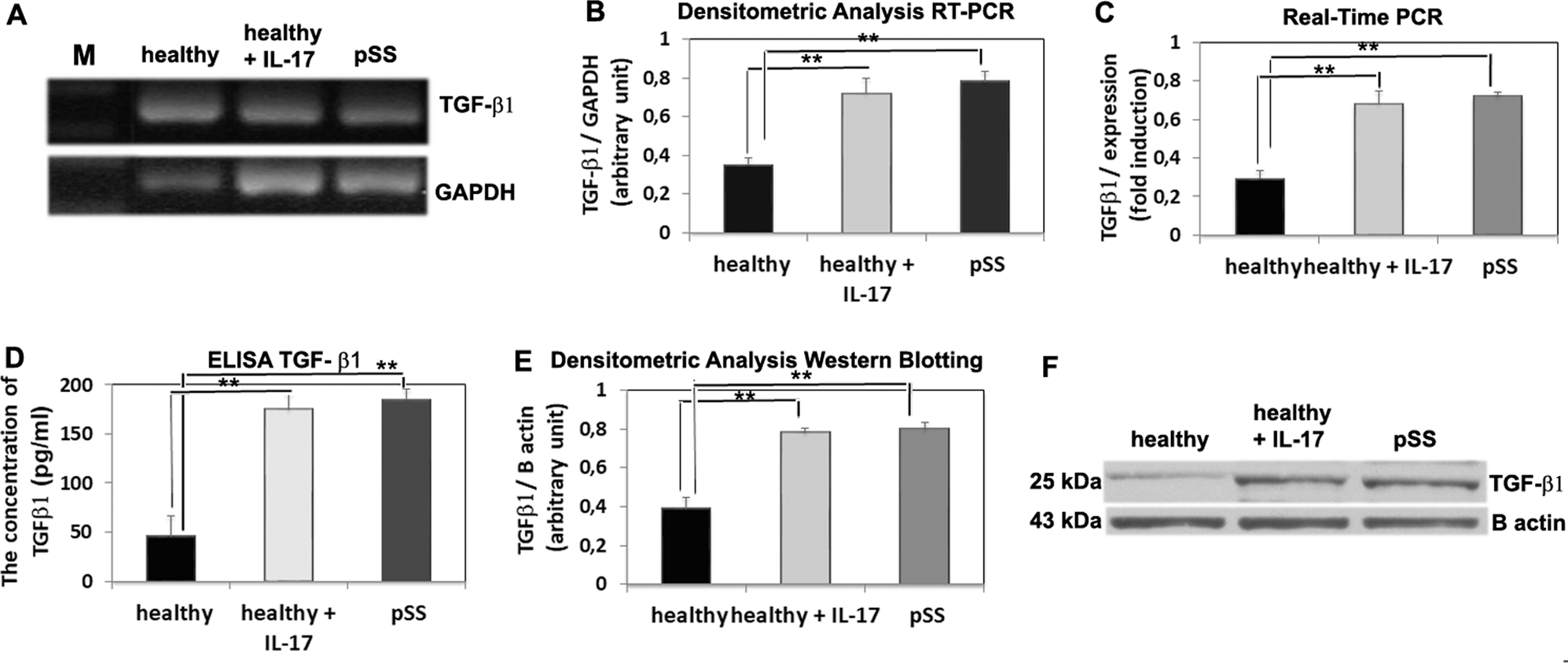 Fig. 1: IL-17 enhanced TGF-β1 expression.
