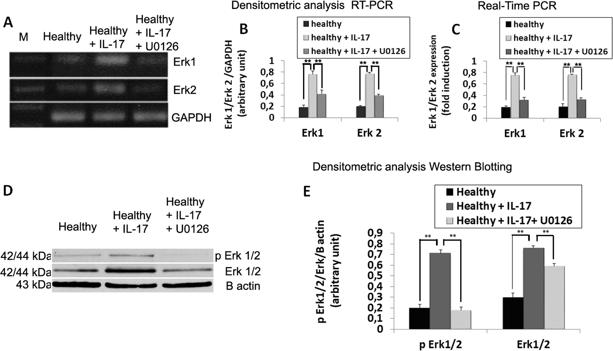 Fig. 3: U0126 inhibitor blocks noncanonical Erk kinase activity induced by IL-17.