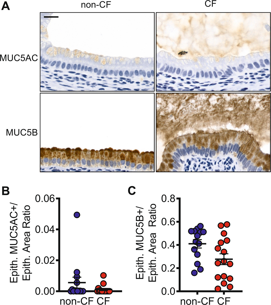 Fig. 6: Newborn CF pigs demonstrate mucus accumulation within the gallbladder lumen, but not in epithelium.