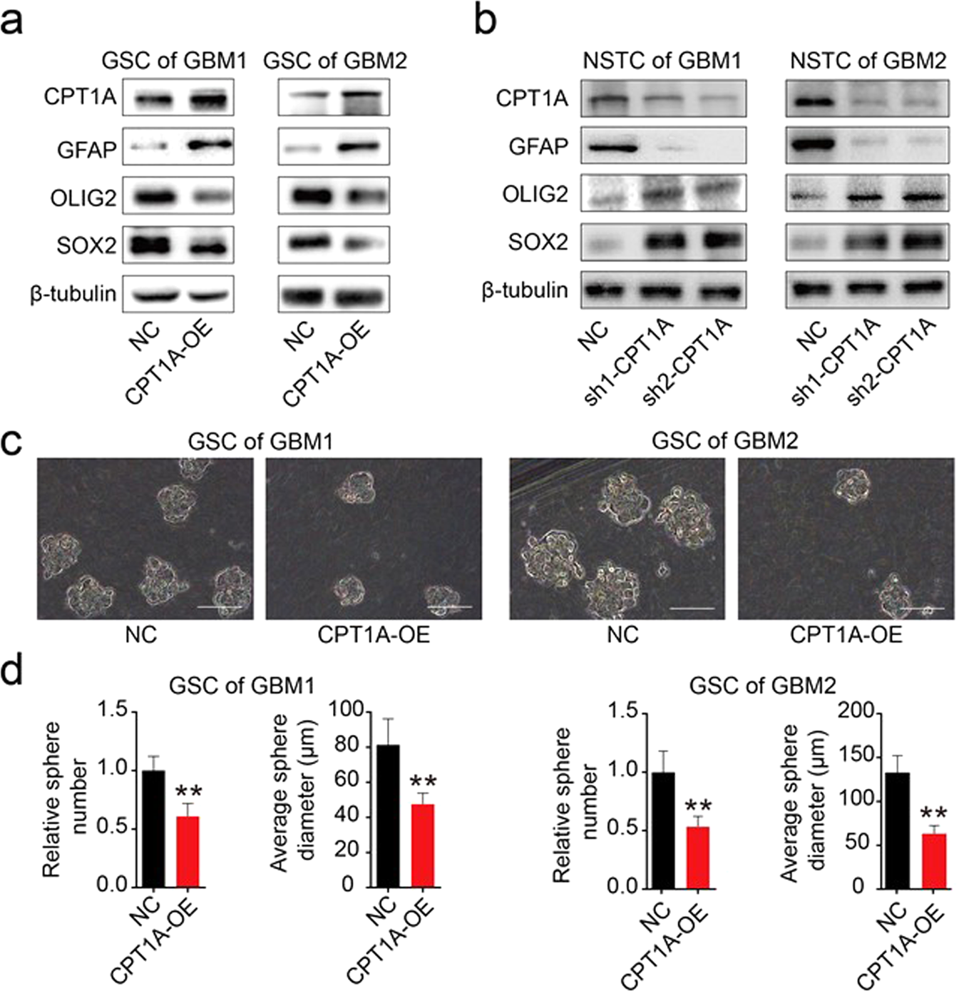 Fig. 2: Overexpression of CPT1A promotes the differentiation of GSCs.