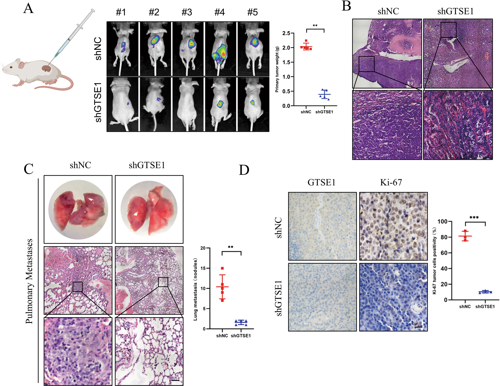 Fig. 5: GTSE1 knockdown suppresses tumor growth and metastasis in vivo.