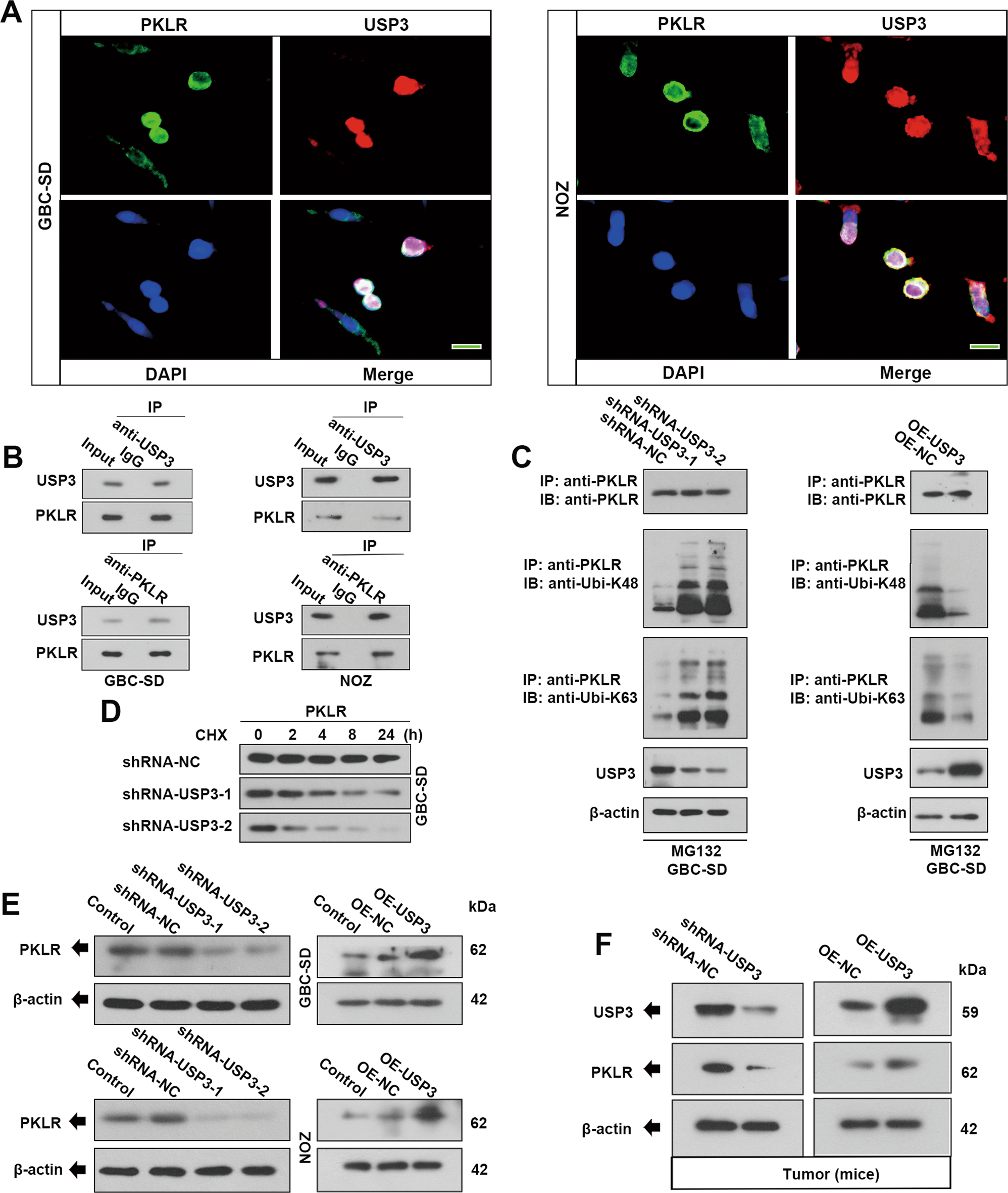 Fig. 4: USP3 regulates the ubiquitination and stability of PKLR in GBC cells.