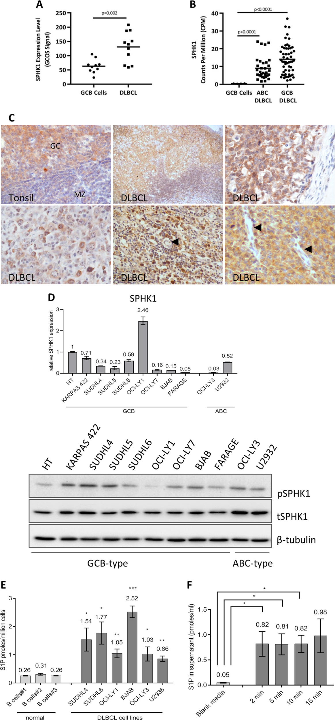 Sphingosine-1-phosphate signalling drives an angiogenic transcriptional  programme in diffuse large B cell lymphoma | Leukemia