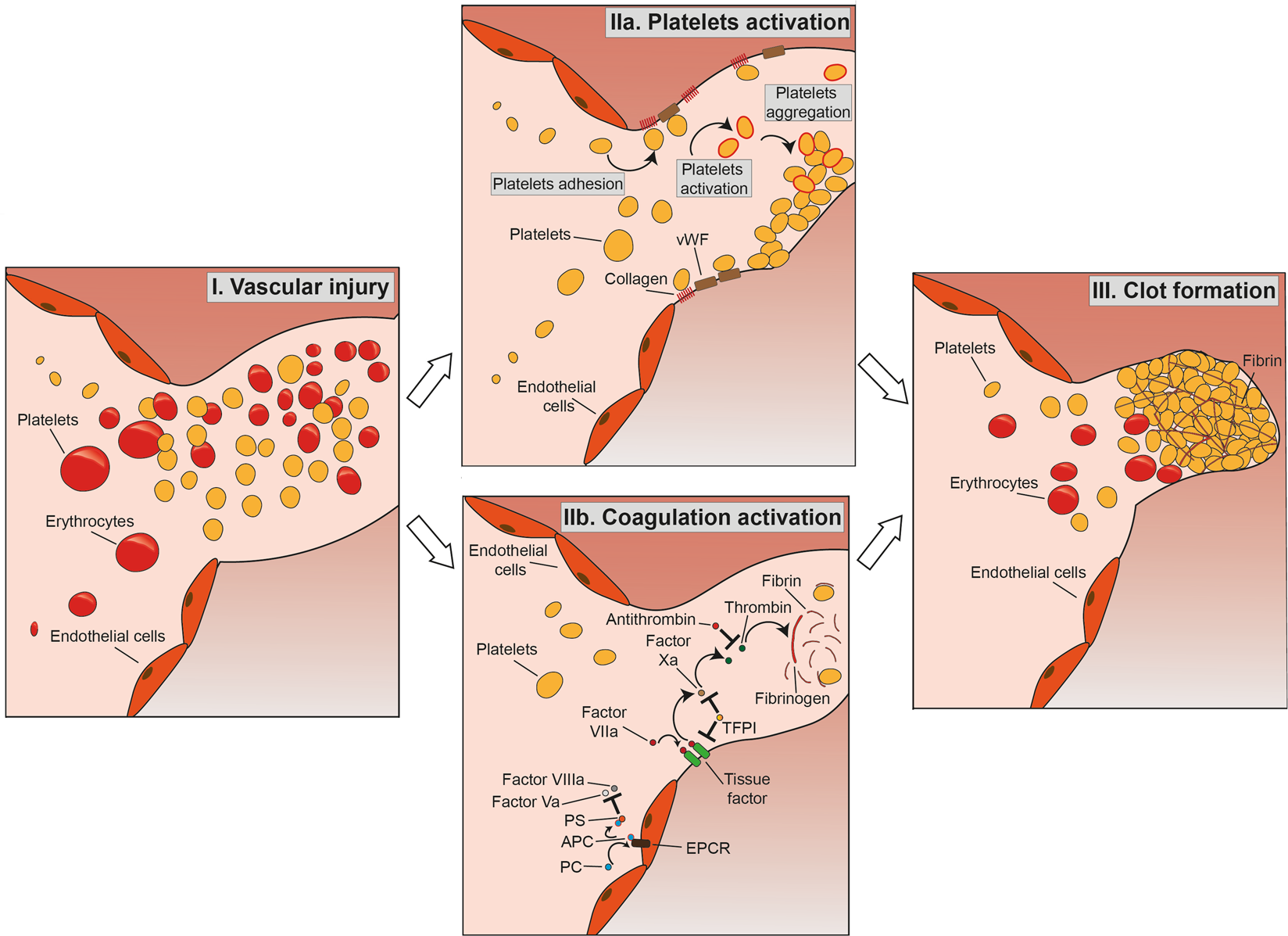 Pathogenesis of cardiovascular events in BCR-ABL1-negative  myeloproliferative neoplasms | Leukemia