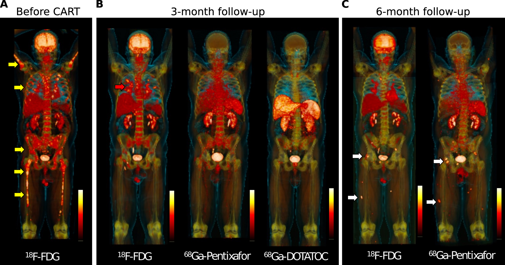Fig. 1: Whole body PET imaging at baseline and during follow-up using multiple PET tracers.