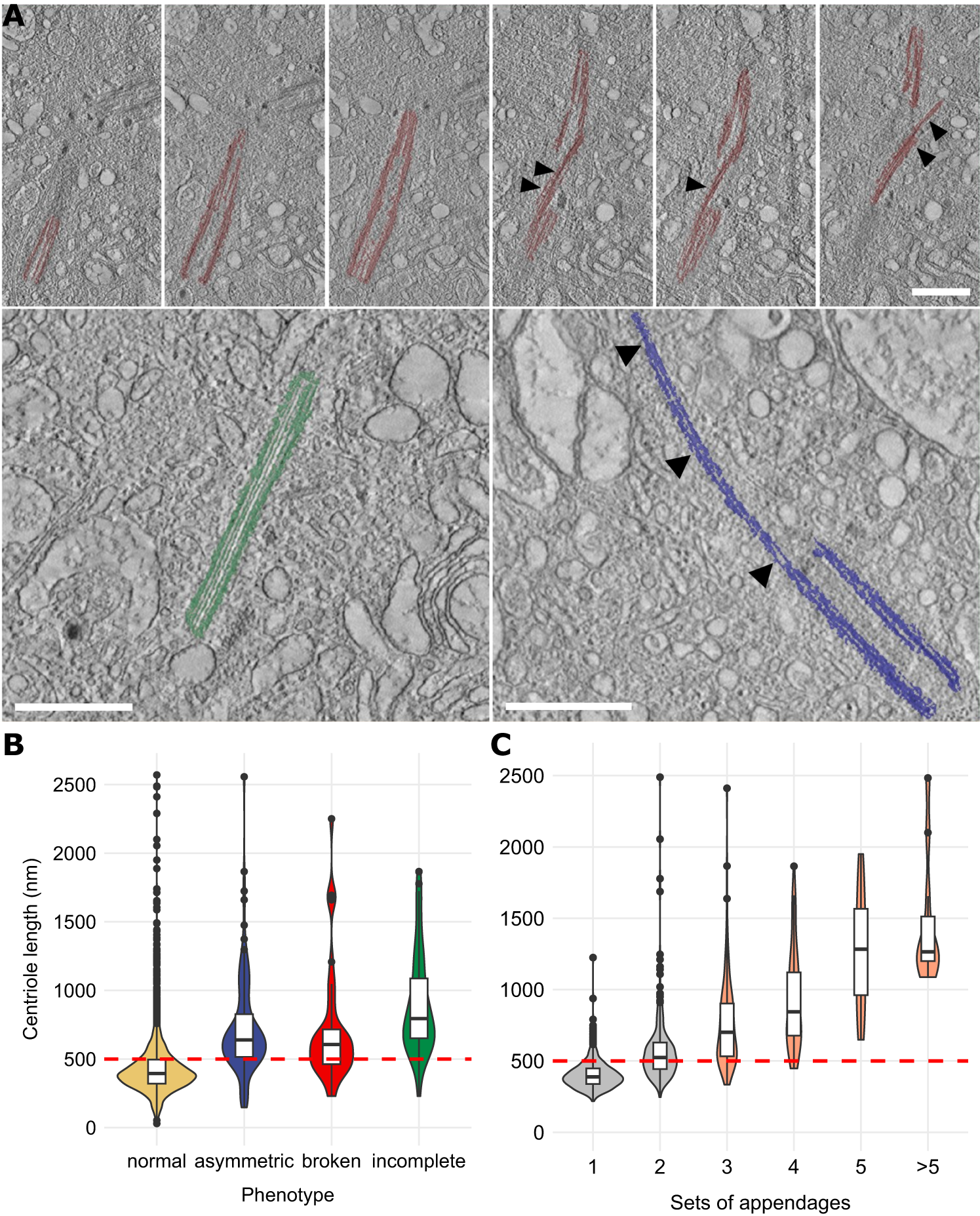 Fig. 4: Over-elongated centrioles in human plasma cells show additional structural abnormalities and are frequently fragmented.