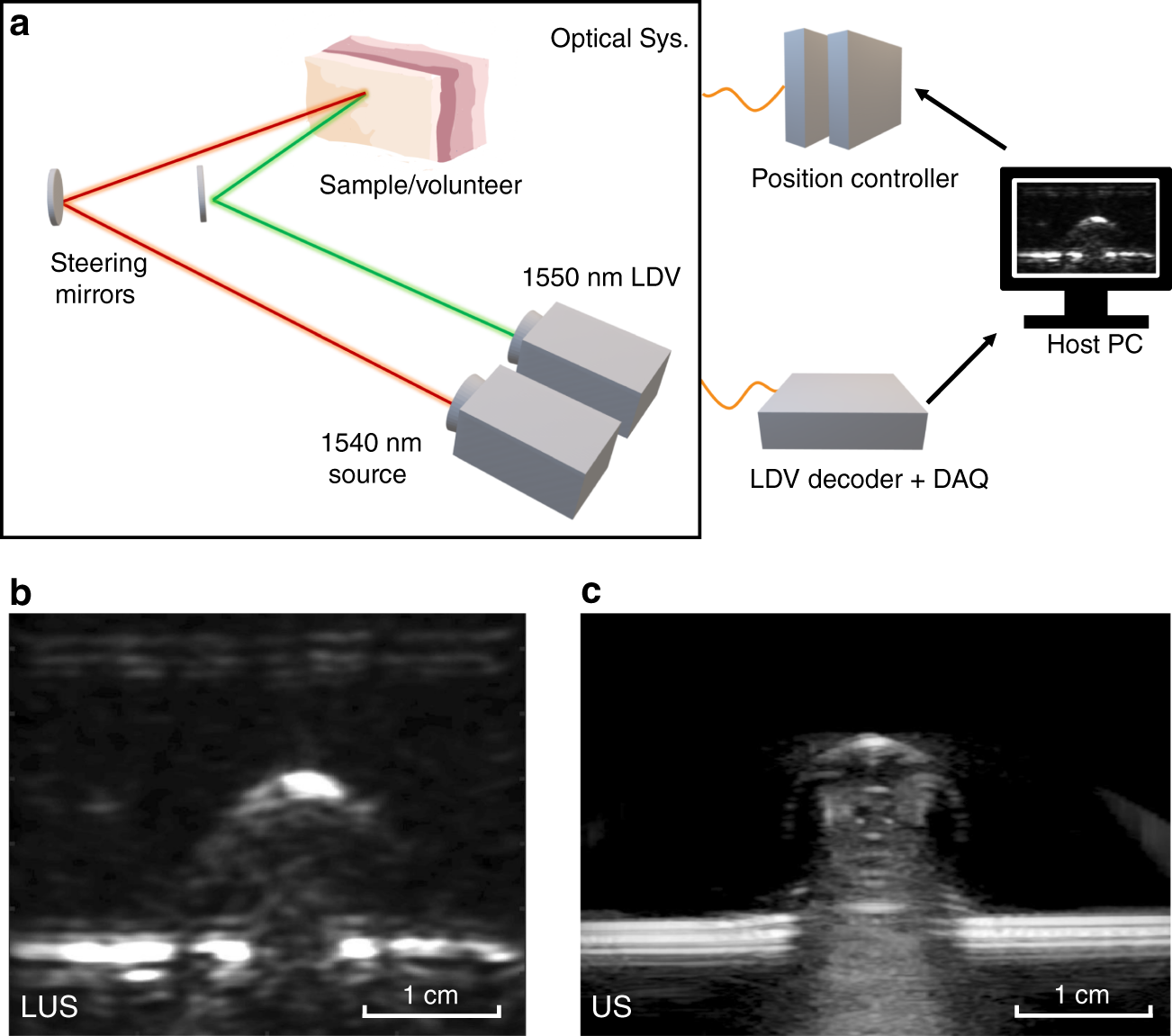 Full noncontact laser ultrasound: first human data | Light: Science &  Applications