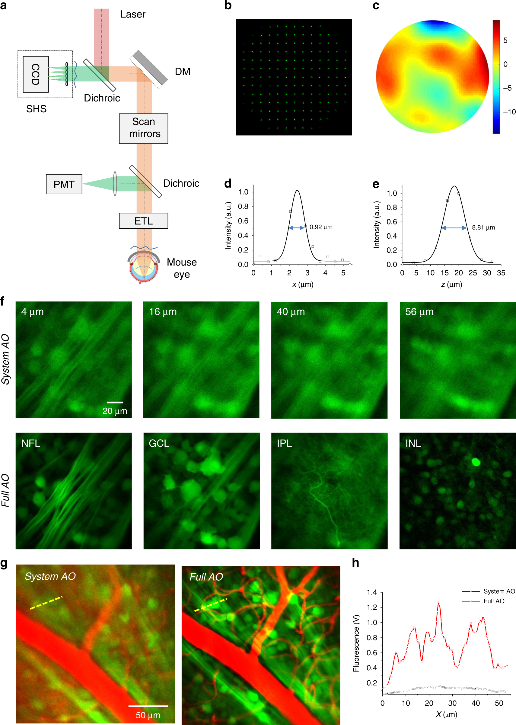A Custom Multiphoton Microscopy Platform for Live Imaging of Mouse Cornea  and Conjunctiva