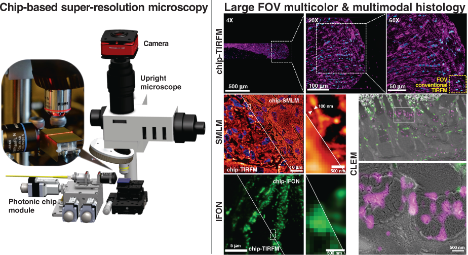 Chip-based multimodal super-resolution microscopy for histological  investigations of cryopreserved tissue sections