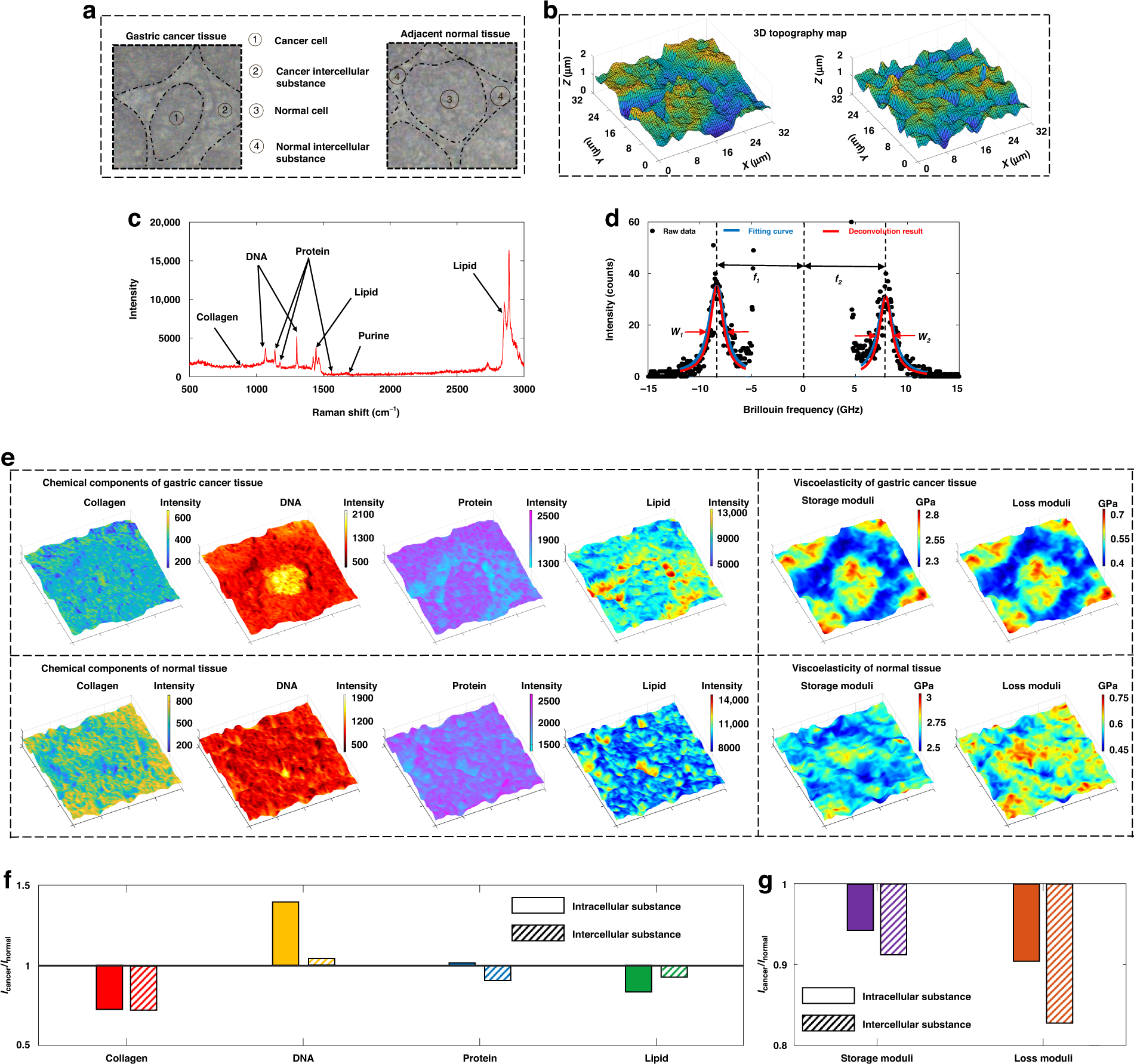 Fig. 4: Mapping results of gastric cancer tissue and normal tissue.