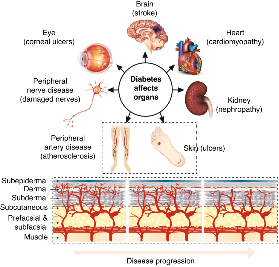 The power of light and sound optoacoustic skin imaging for ...