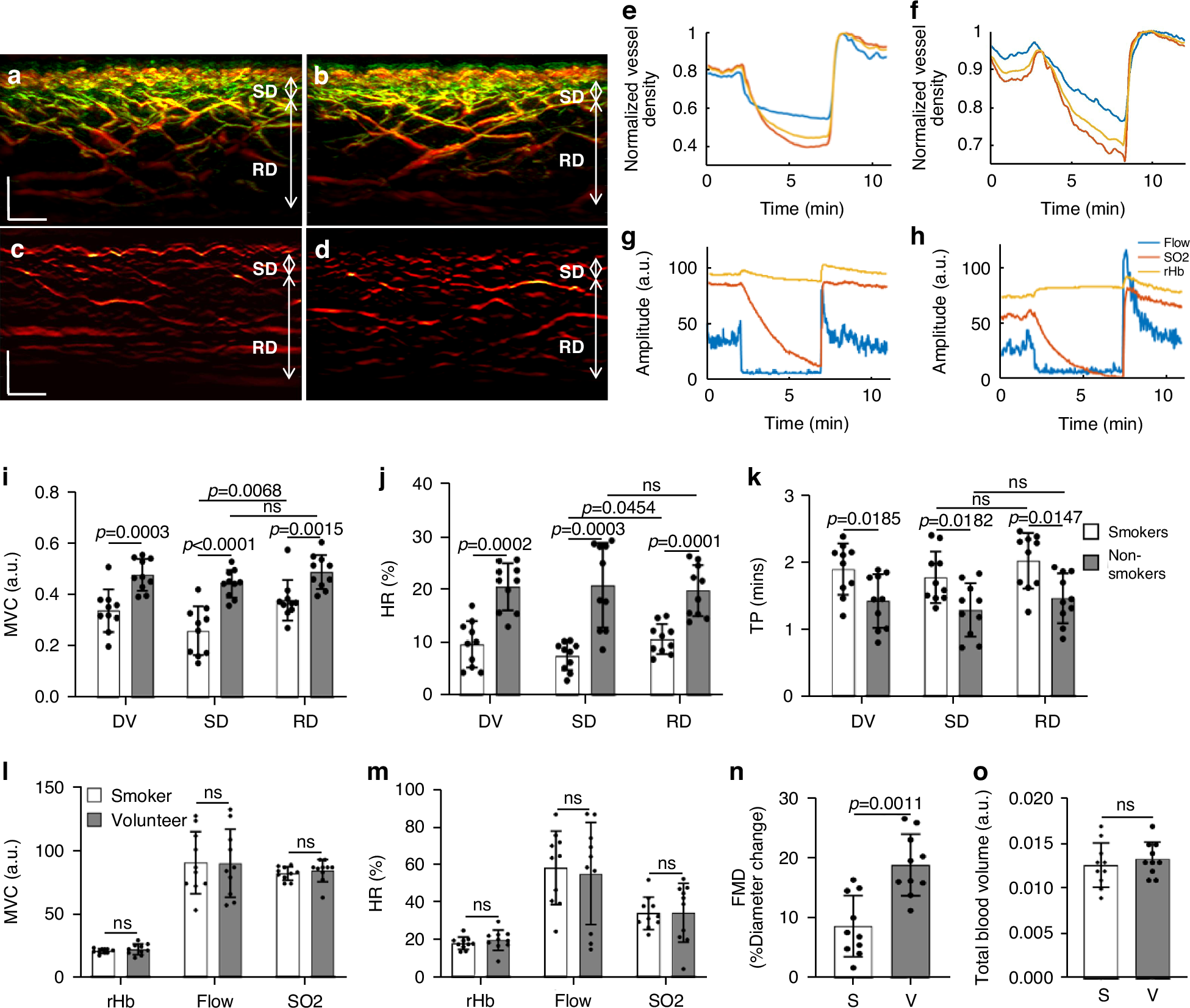 Fig. 4: Quantification and comparisons of skin microvasculature endothelial function between non-smokers and smokers.