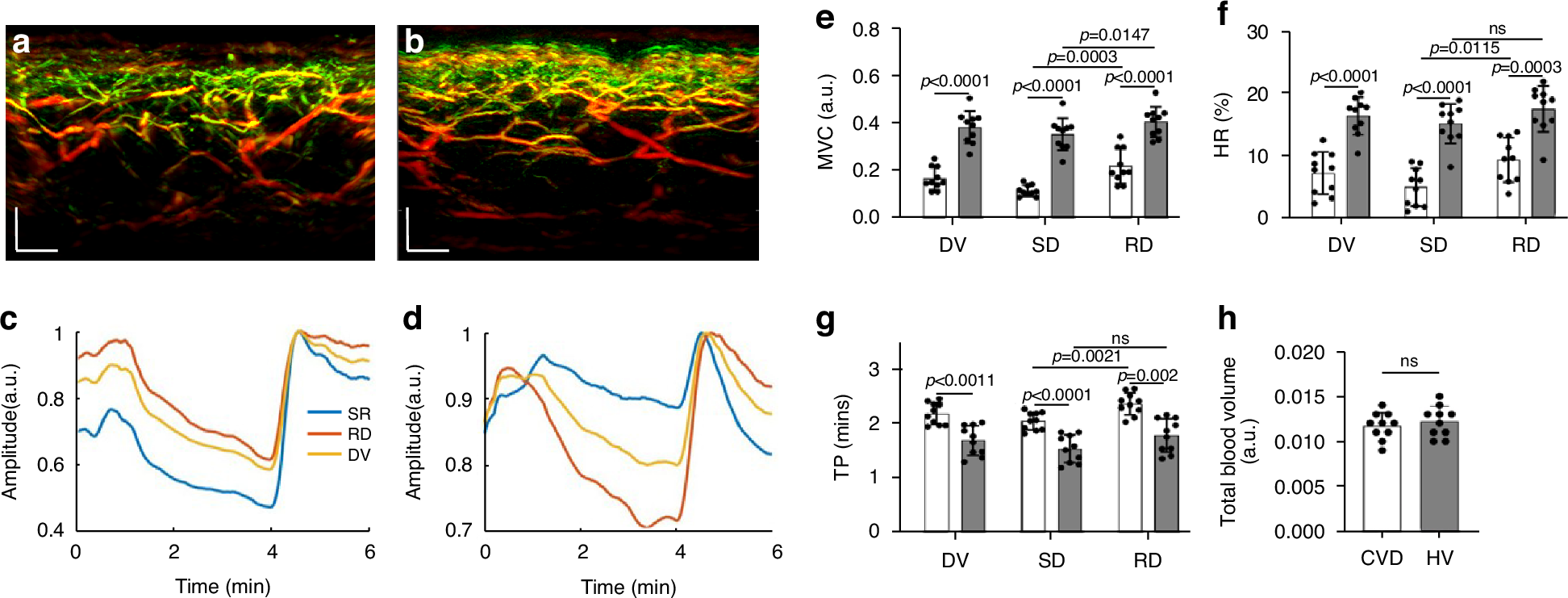 Fig. 5: Comparisons of skin microvasculature endothelial function between volunteers with and without CVD.
