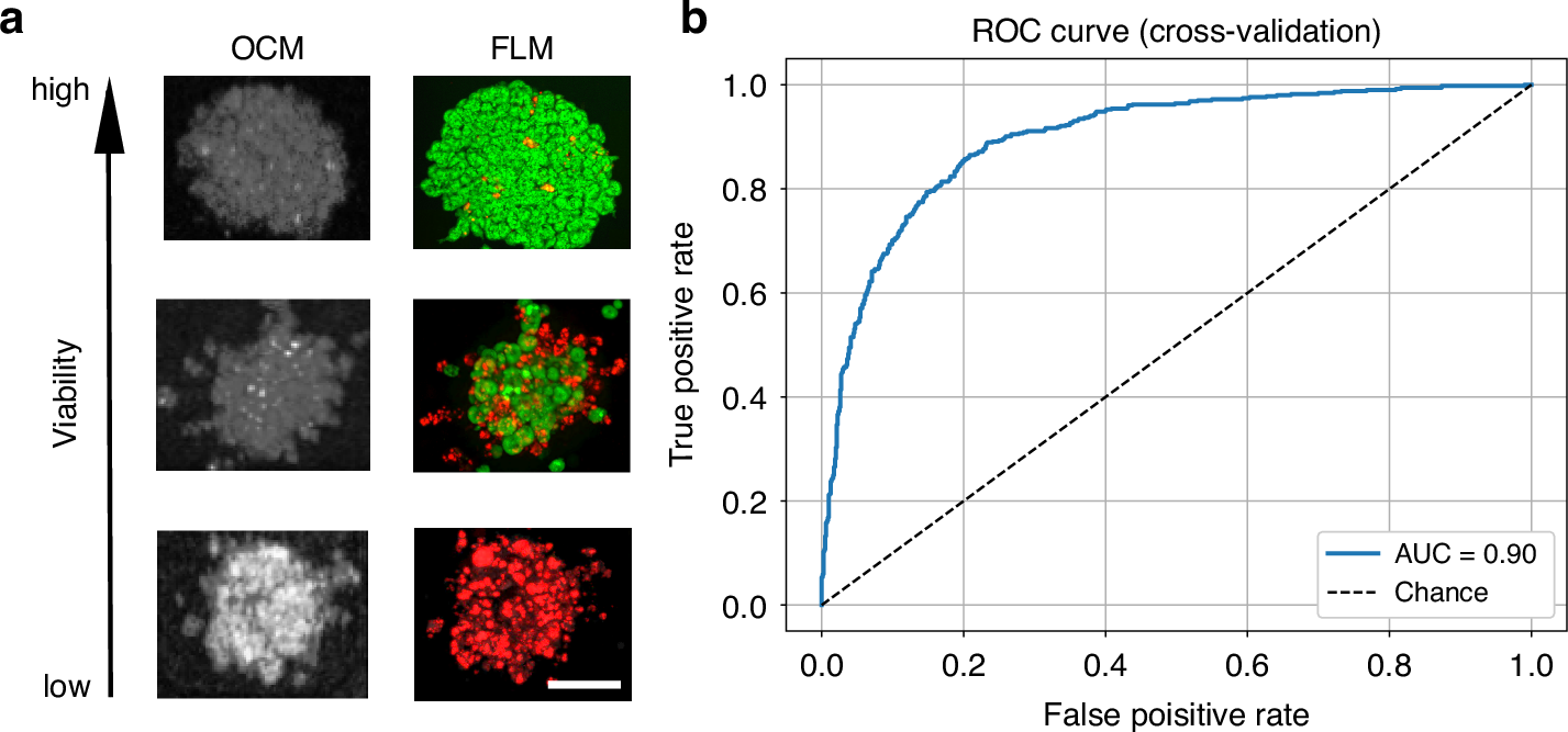 Fig. 5: Differentiation between live and dead organoids via radiomics-based classification of OCM data.