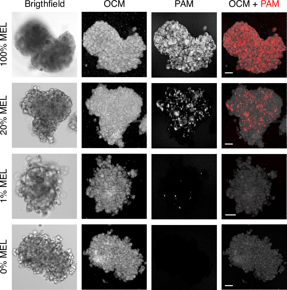 Fig. 7: Representative images of cancer spheroid models.