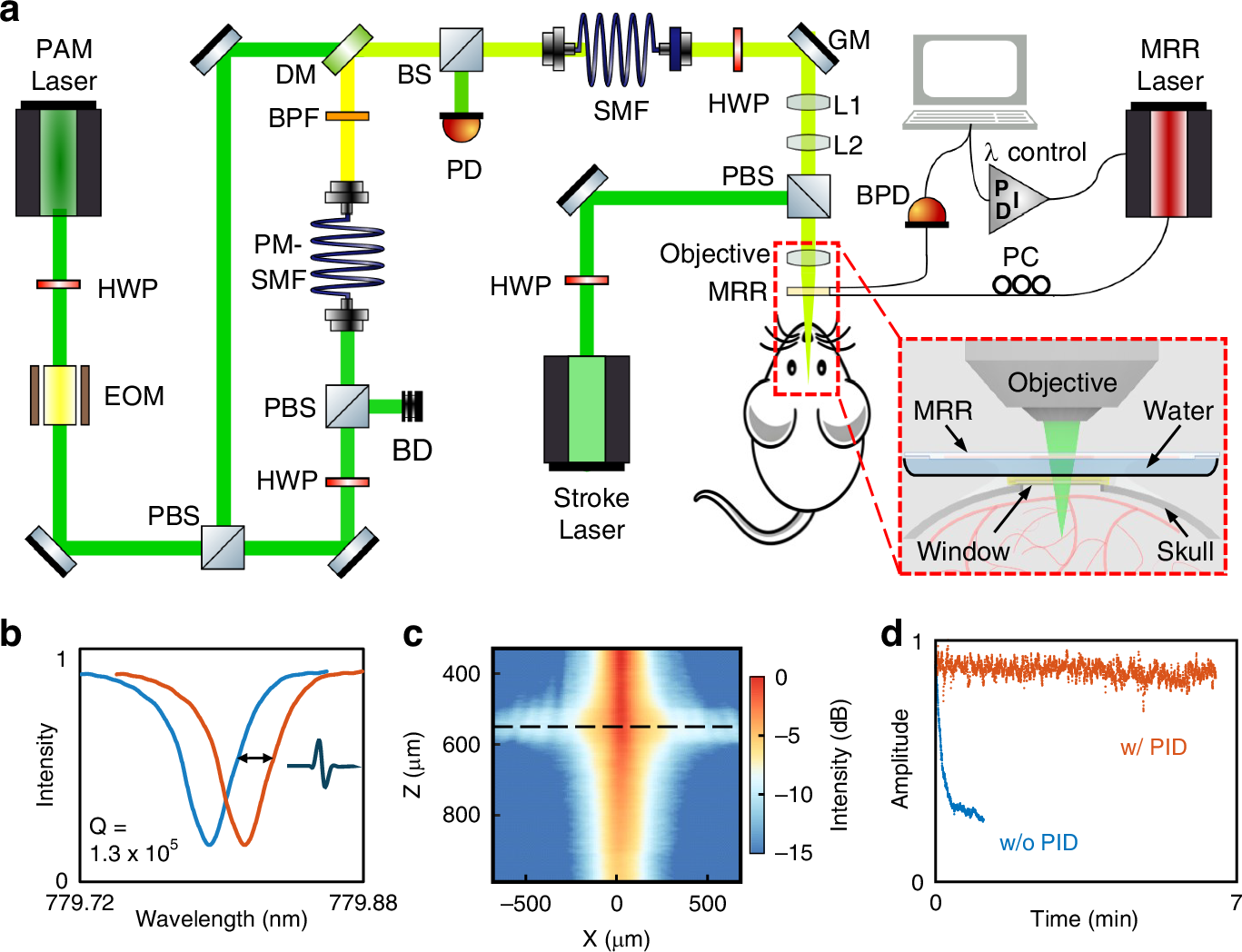 単一赤血球レベルで脳血流を可視化（Tracking single red blood cells as they move through the brain）