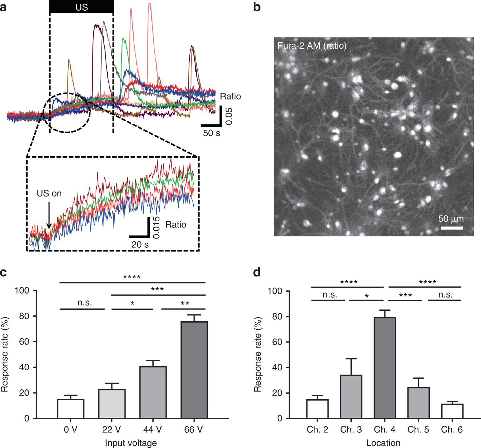Fig. 7: Responses of cocultured cells stimulated by the ultrasound from the pMUT array through measurement of the real-time change in the intracellular Ca2+ concentration.