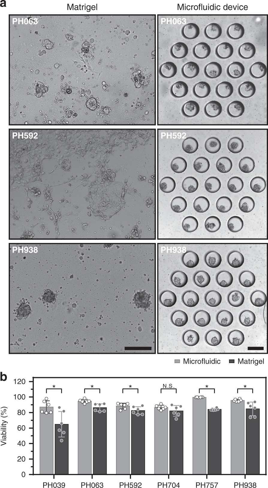 Fig. 3: Comparison of spheroid cultures on Matrigel and in microfluidic devices.