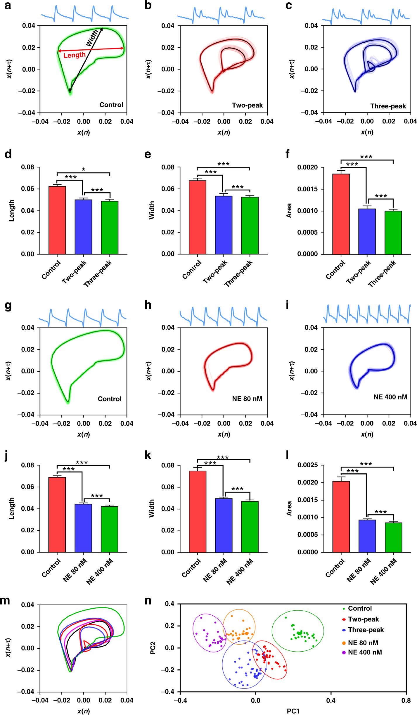 Fig. 6: Arrhythmia classification by the biosensing system with MNDA analysis.