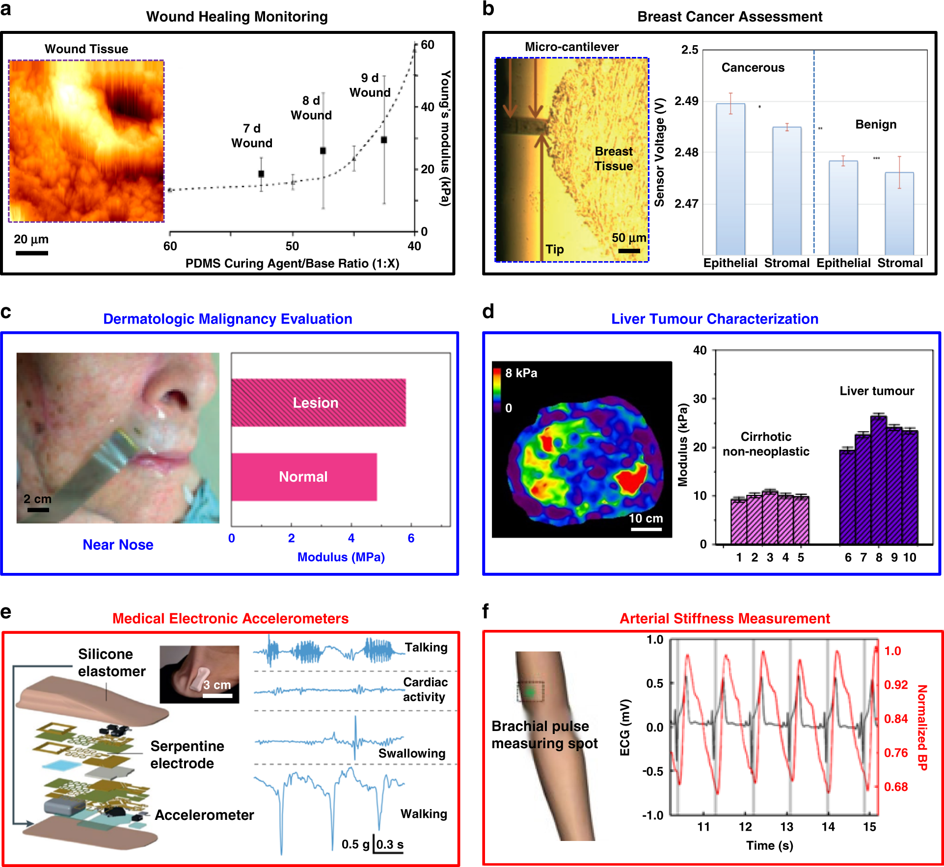 Fig. 6: Clinical applications of mechanical sensing/monitoring.