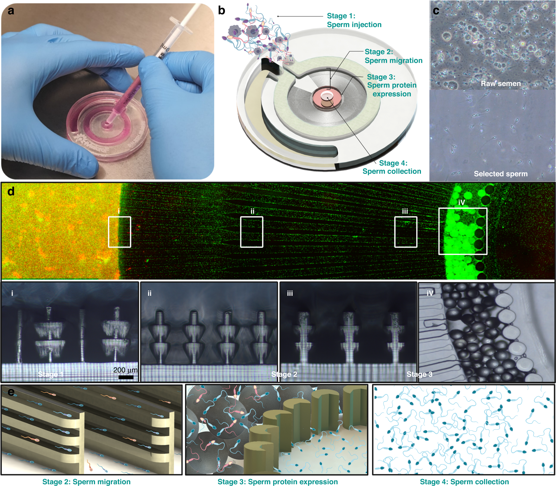 Sperm quality metrics were improved by a biomimetic microfluidic selection platform compared to swim-up methods Microsystems and Nanoengineering image
