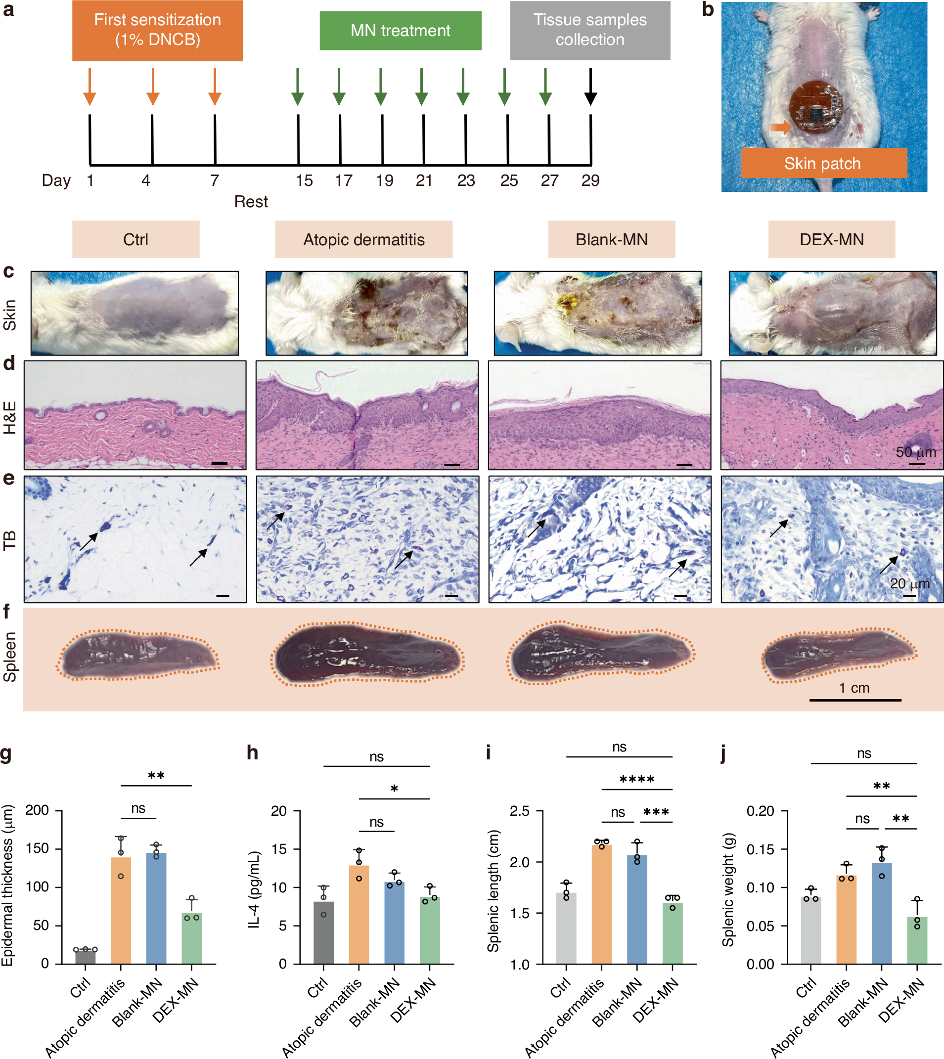 Fig. 6: Therapeutic efficacy of the skin patch for atopic dermatitis in vivo.