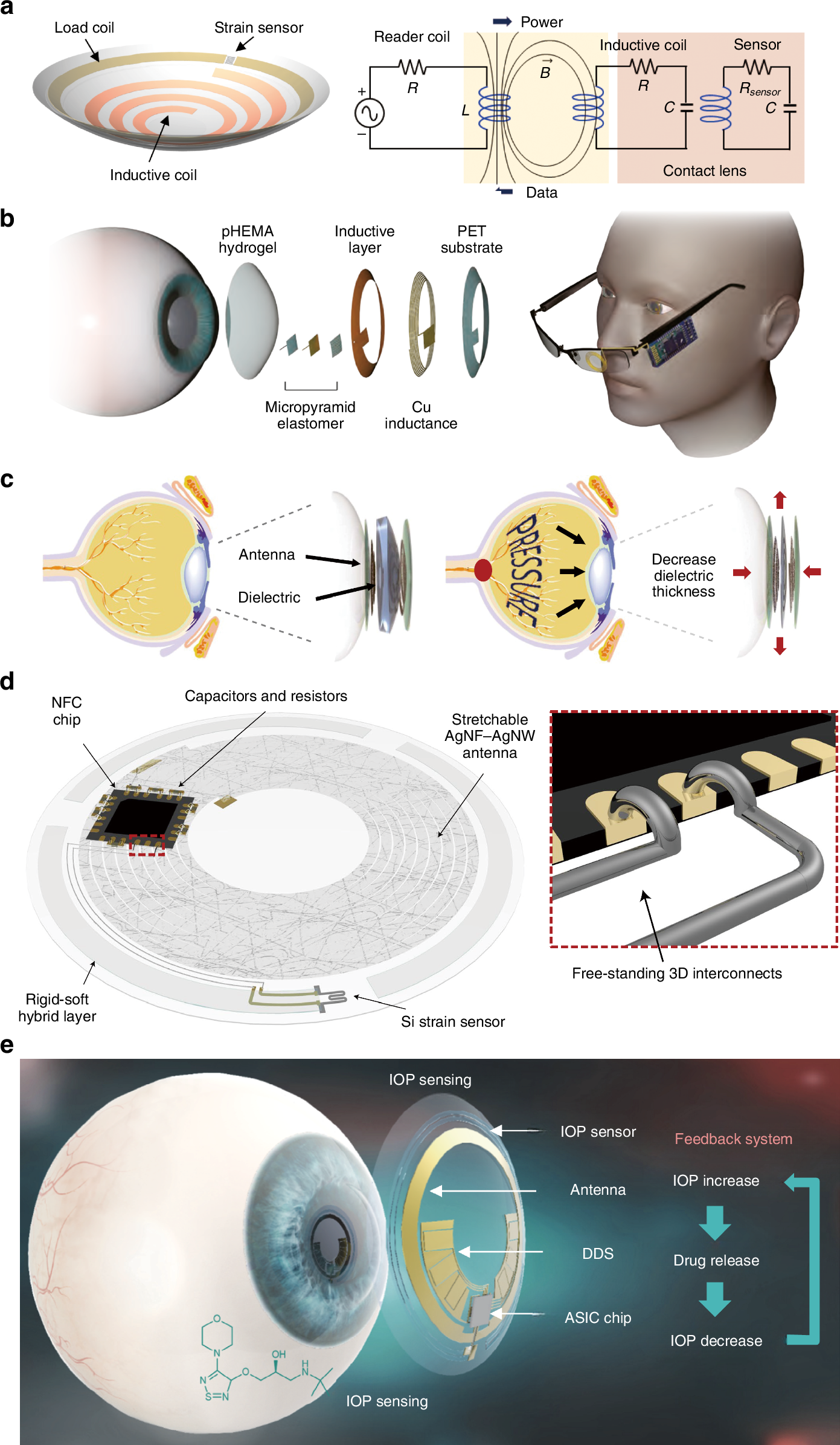 Fig. 3: A variety of NFC/RFID-based contact lens designs with the ability to monitor IOP.