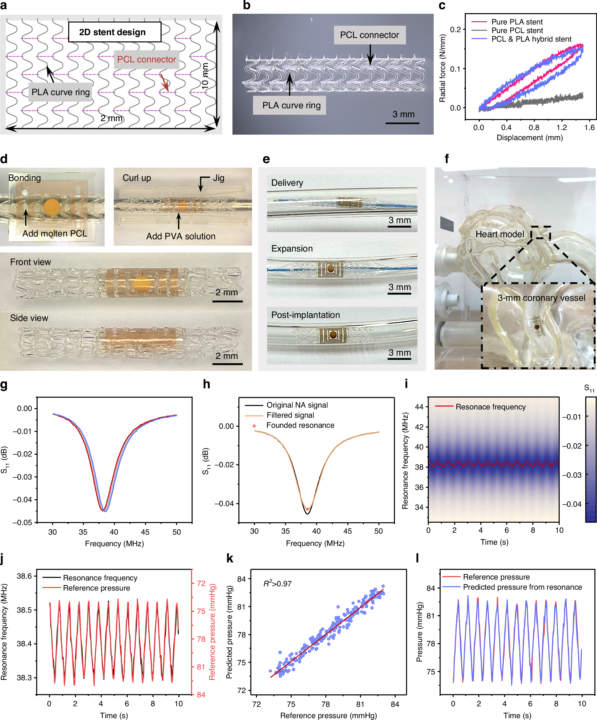 Fig. 4: Fabrication, integration, deployment, and functional validation of the smart stent system.